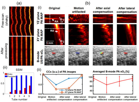 Review of Three-Dimensional Handheld Photoacoustic and Ultrasound ...