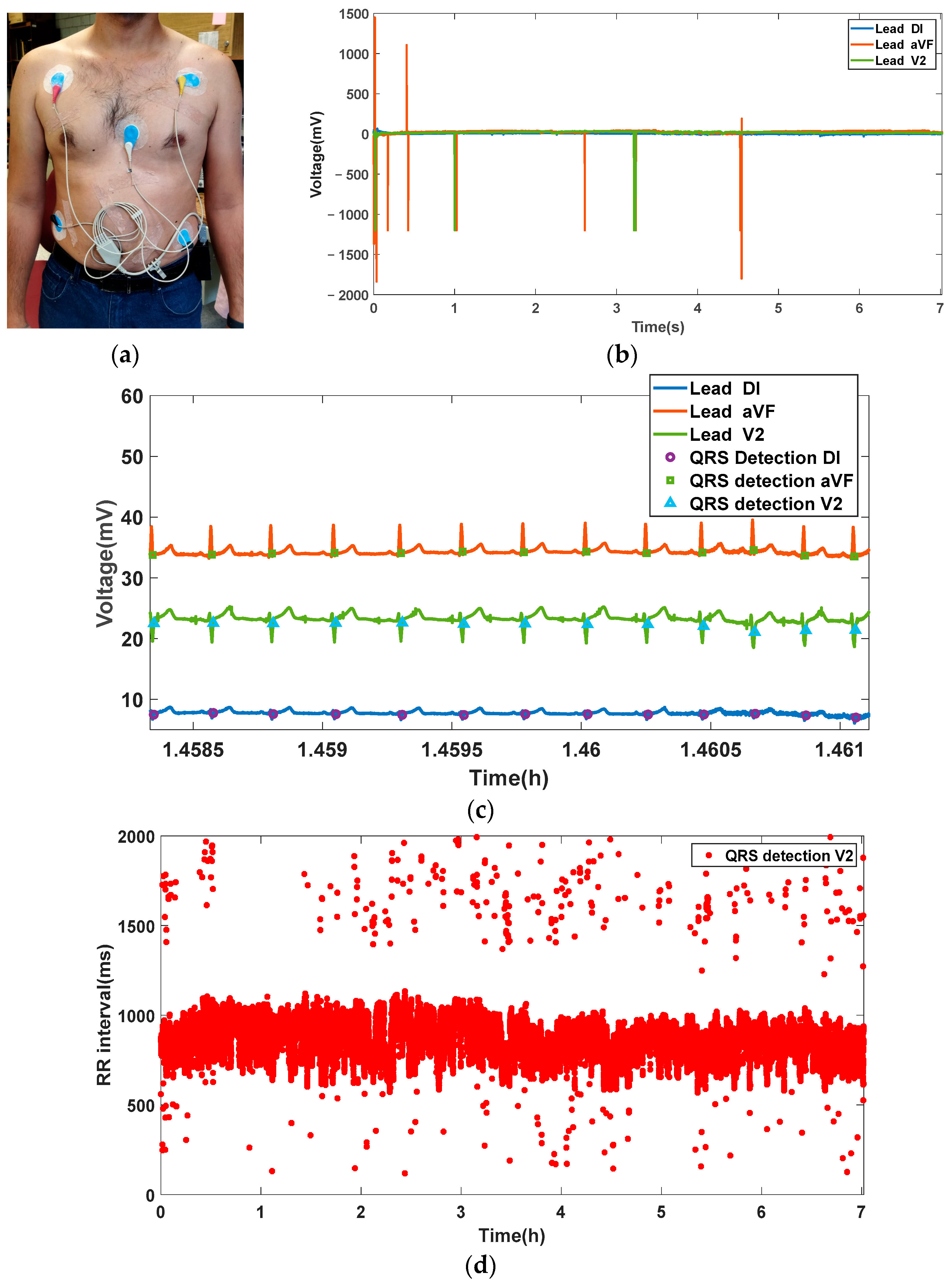 Sensors 23 08303 g017