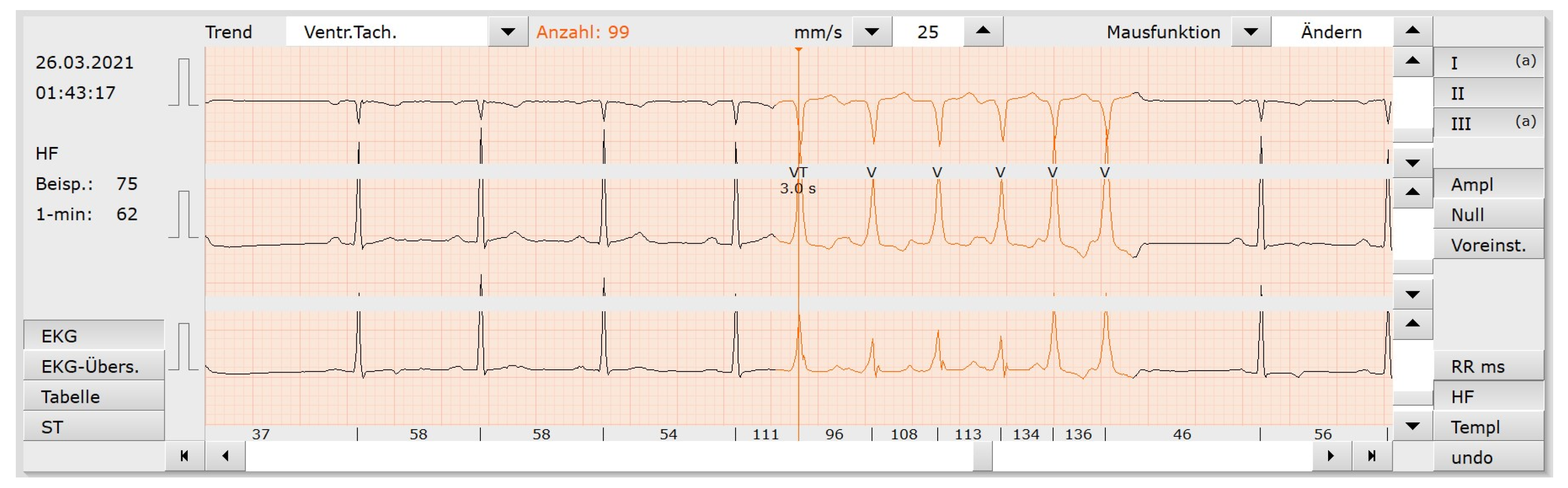 Sensors 23 08573 g007