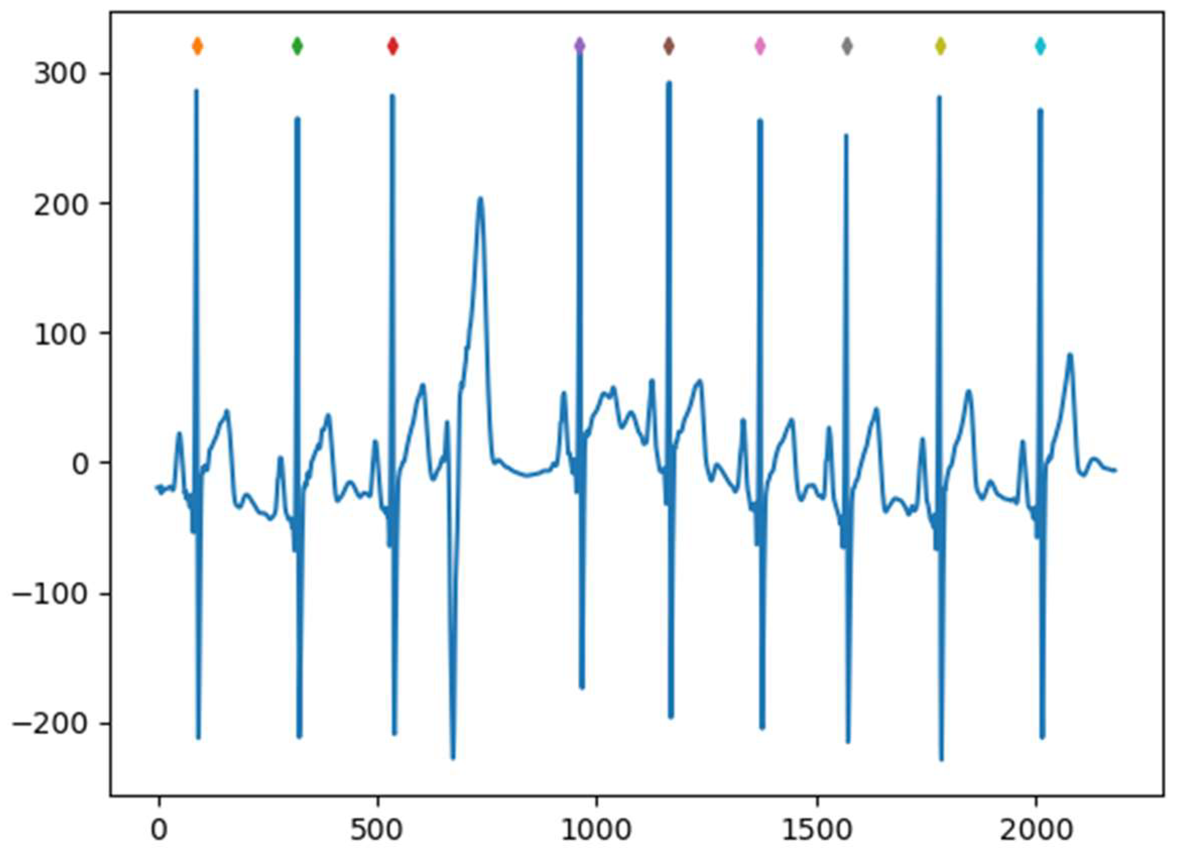 Sensors 23 08636 g004