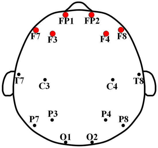 Depressive Disorder Recognition Based on Frontal EEG Signals Depressive Disorder Recognition Based on Frontal EEG Signals