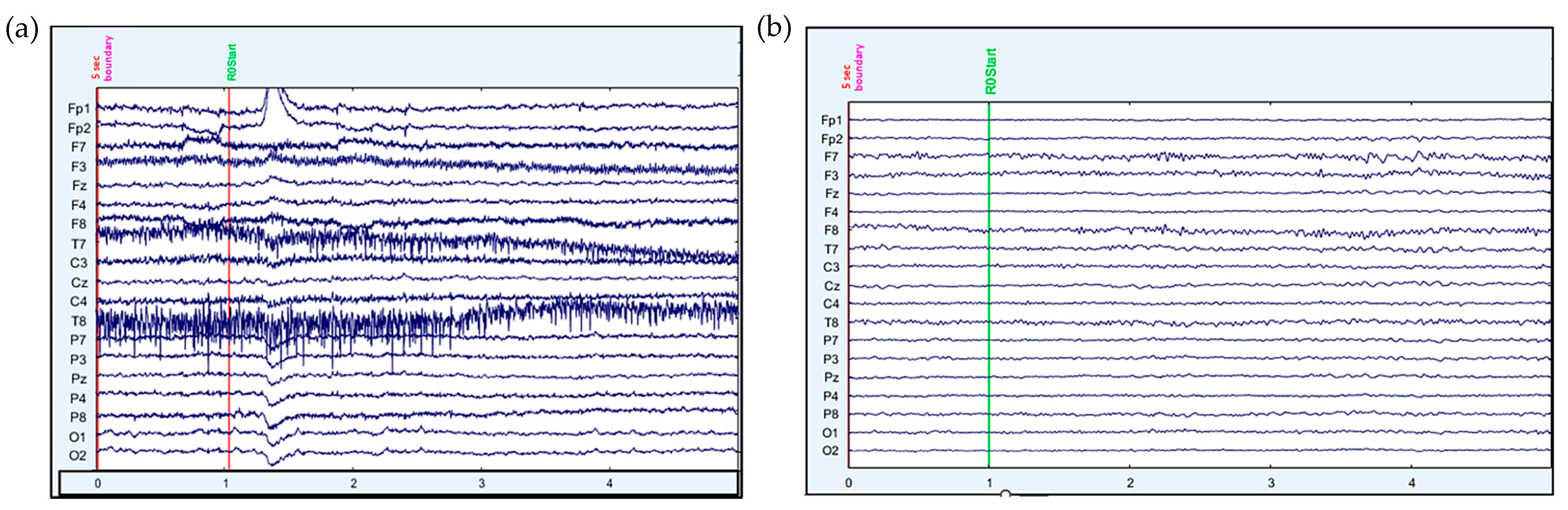 Sensors 23 08926 g004