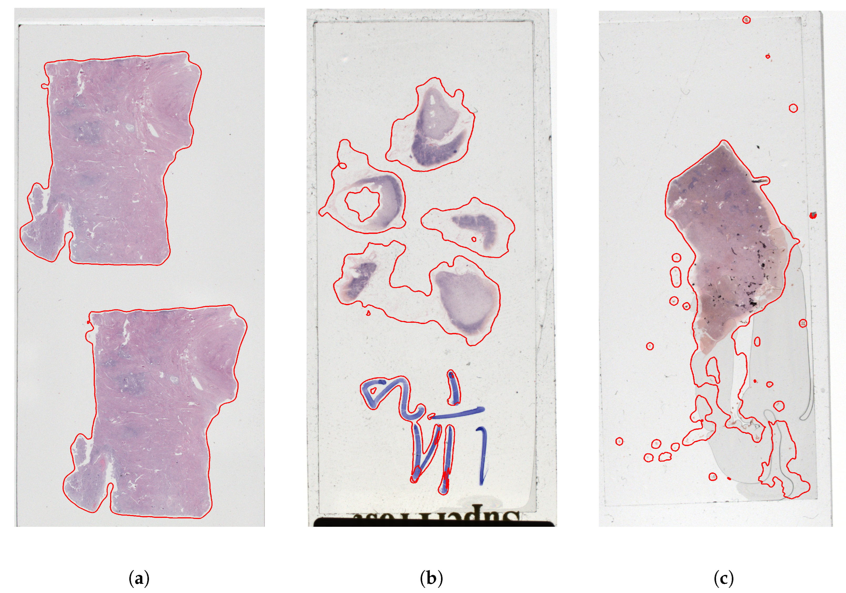 Sensors 23 09243 g004