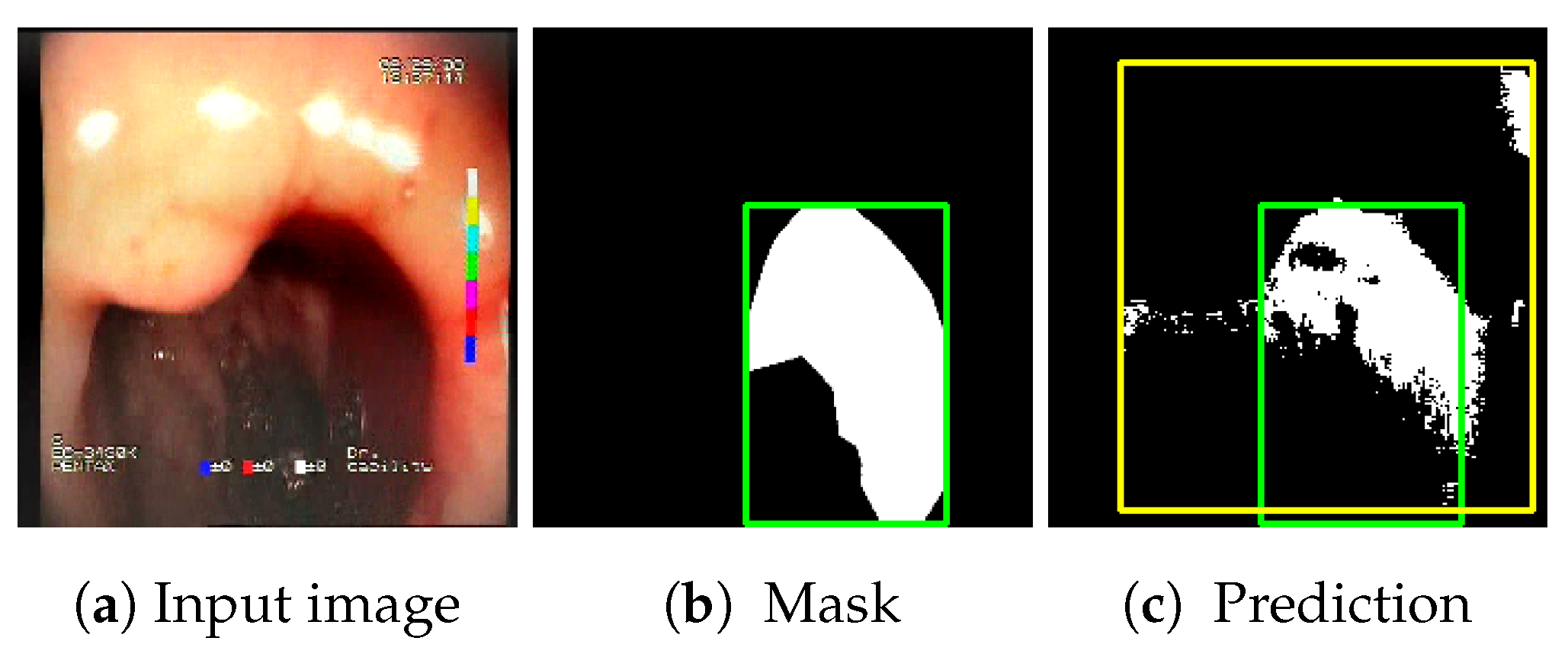 Sensors 23 09717 g006