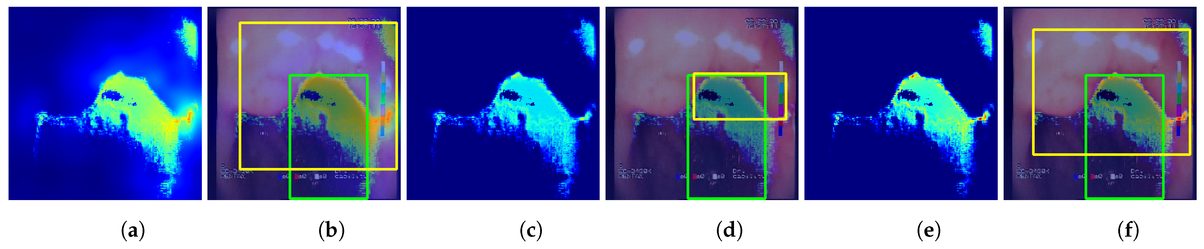 Sensors 23 09717 g008