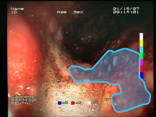 Sensors 23 09717 i002