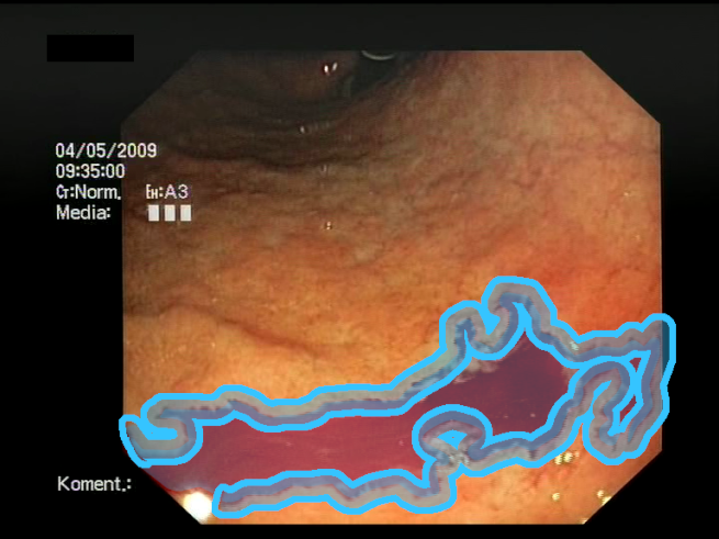 Sensors 23 09717 i006