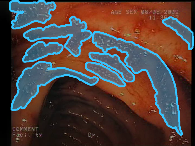 Sensors 23 09717 i008