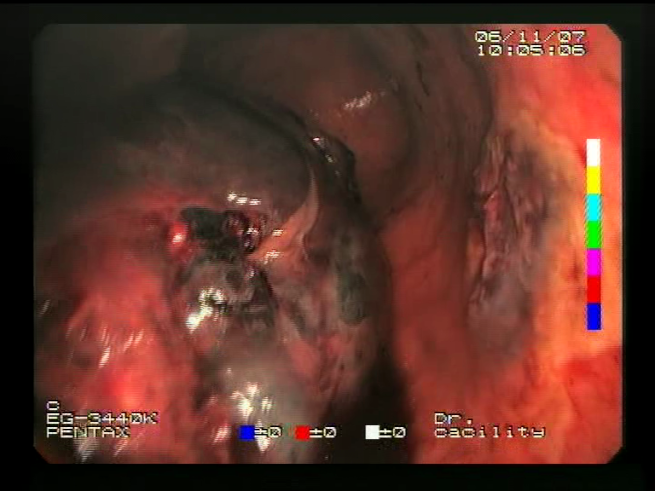 Sensors 23 09717 i009