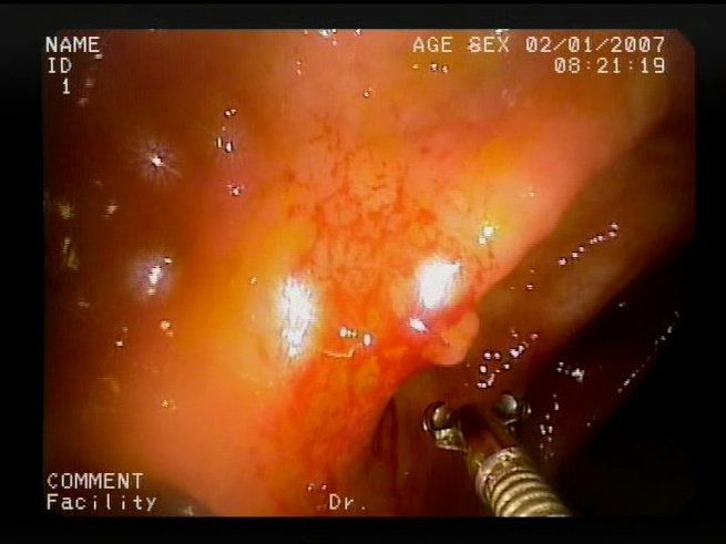 Sensors 23 09717 i011