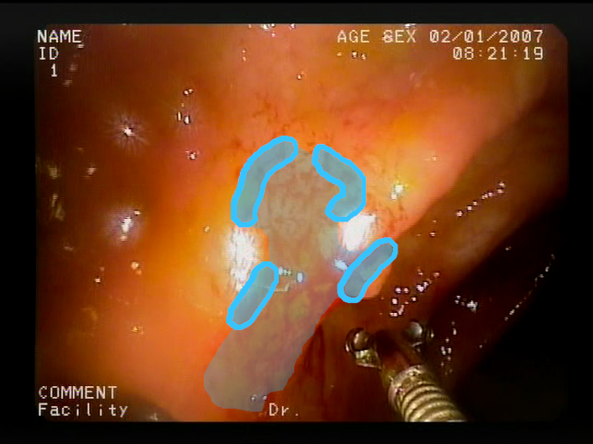 Sensors 23 09717 i012