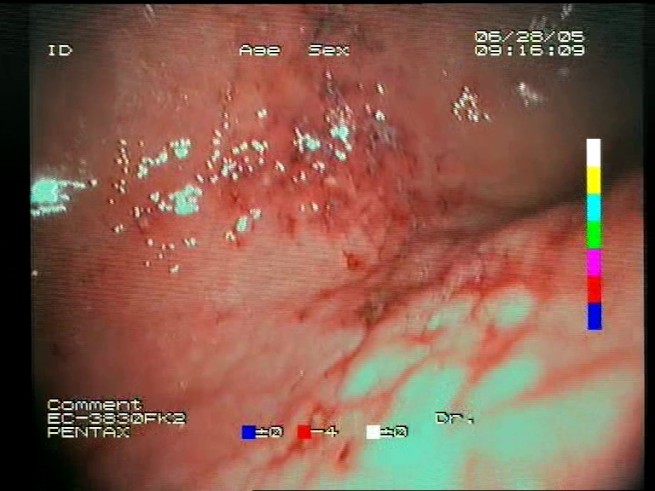 Sensors 23 09717 i013