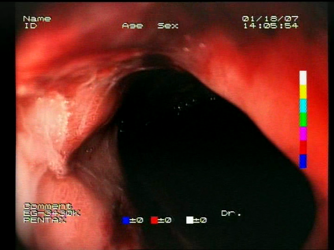 Sensors 23 09717 i015