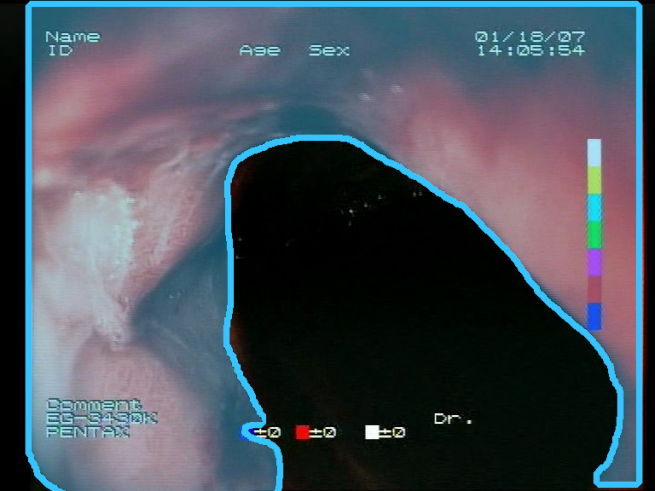 Sensors 23 09717 i016