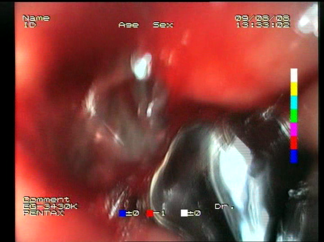 Sensors 23 09717 i017