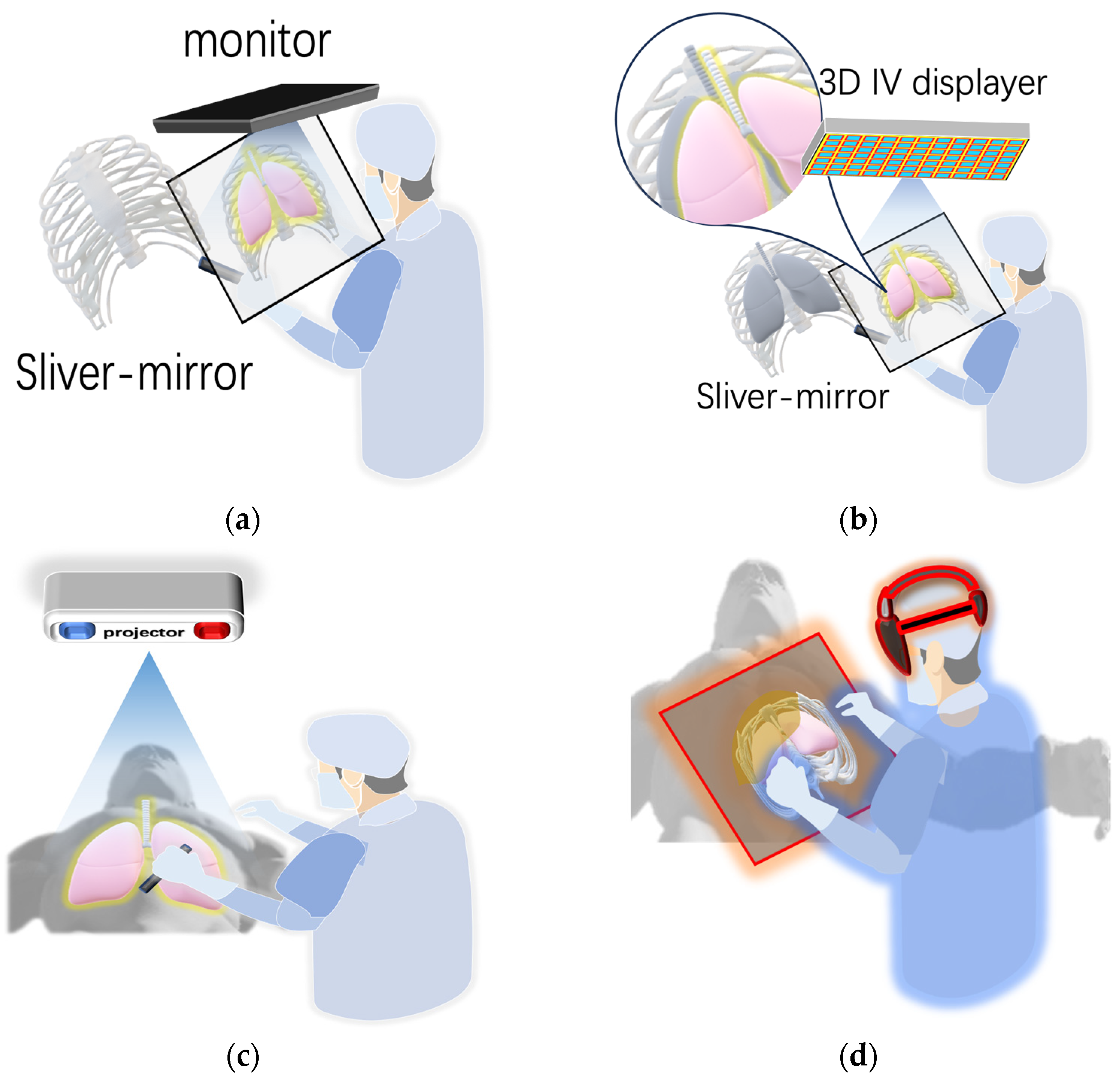 Sensors | Free Full-Text | Modern Image-Guided Surgery: A Narrative ...