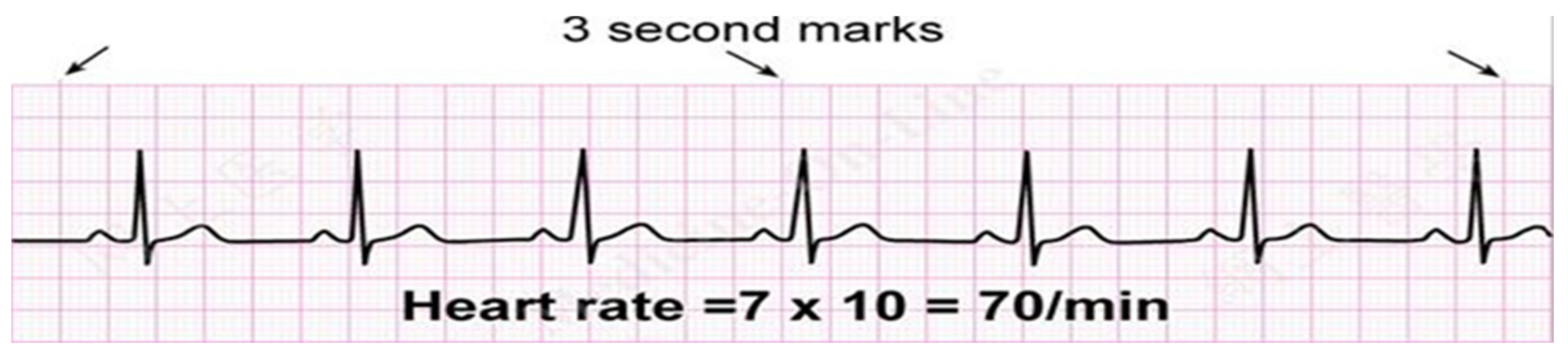 Sensors 24 00018 g005