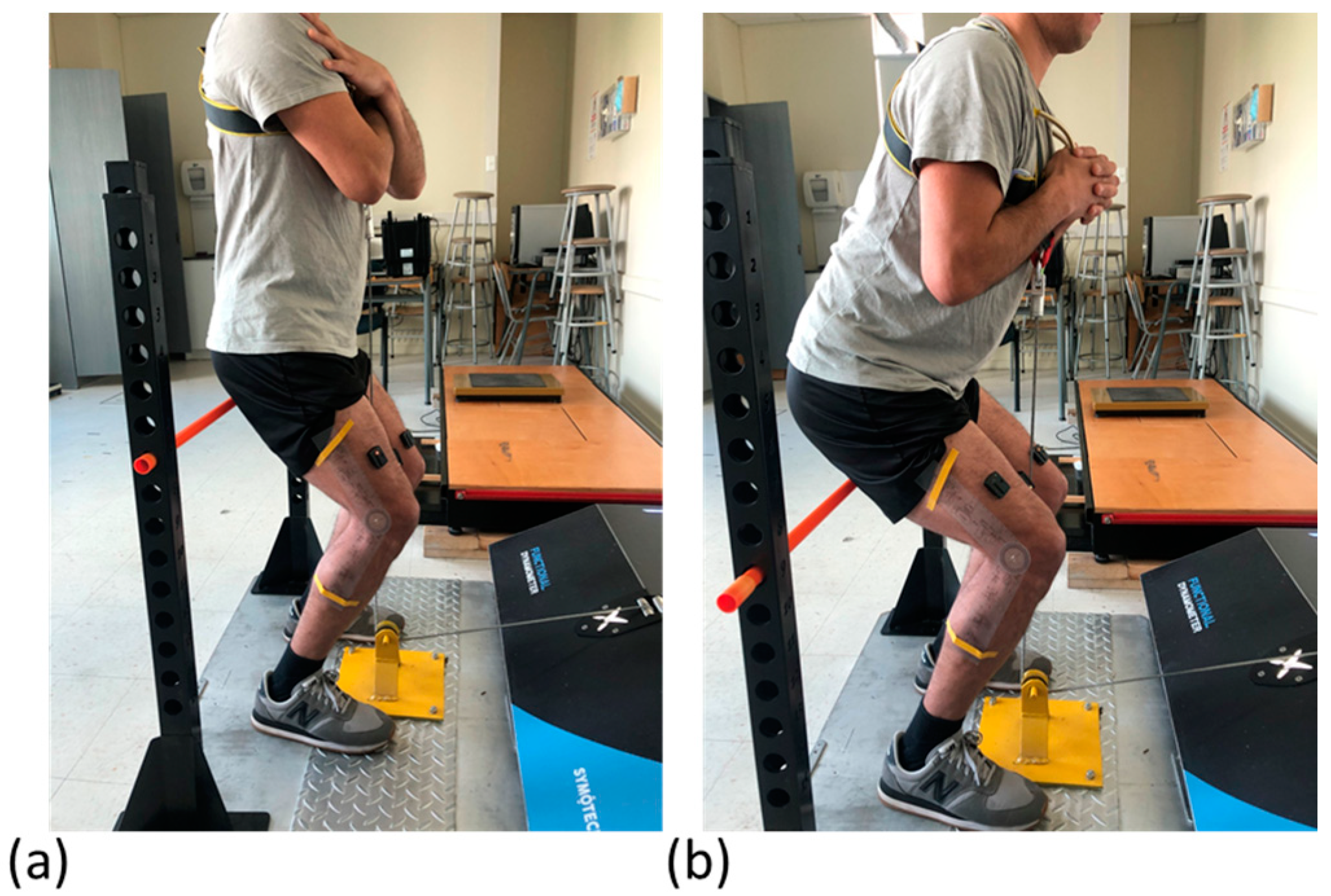 Sensors 24 00044 g001 Sensors 24 00044 g001