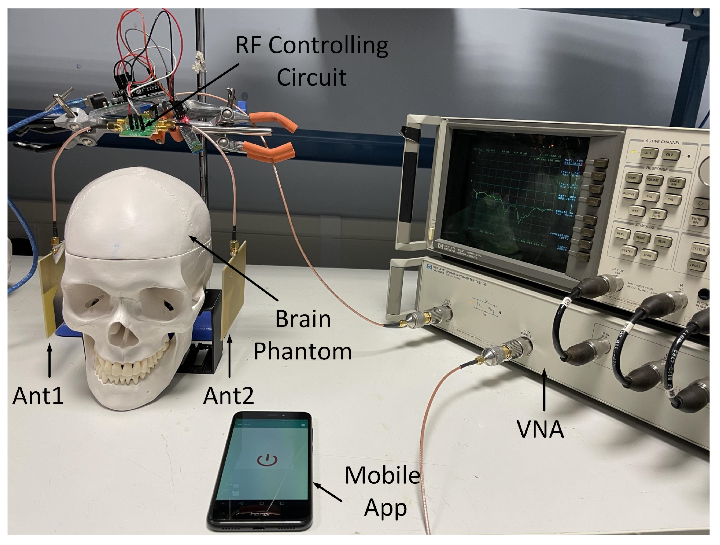Sensors 24 00328 g016