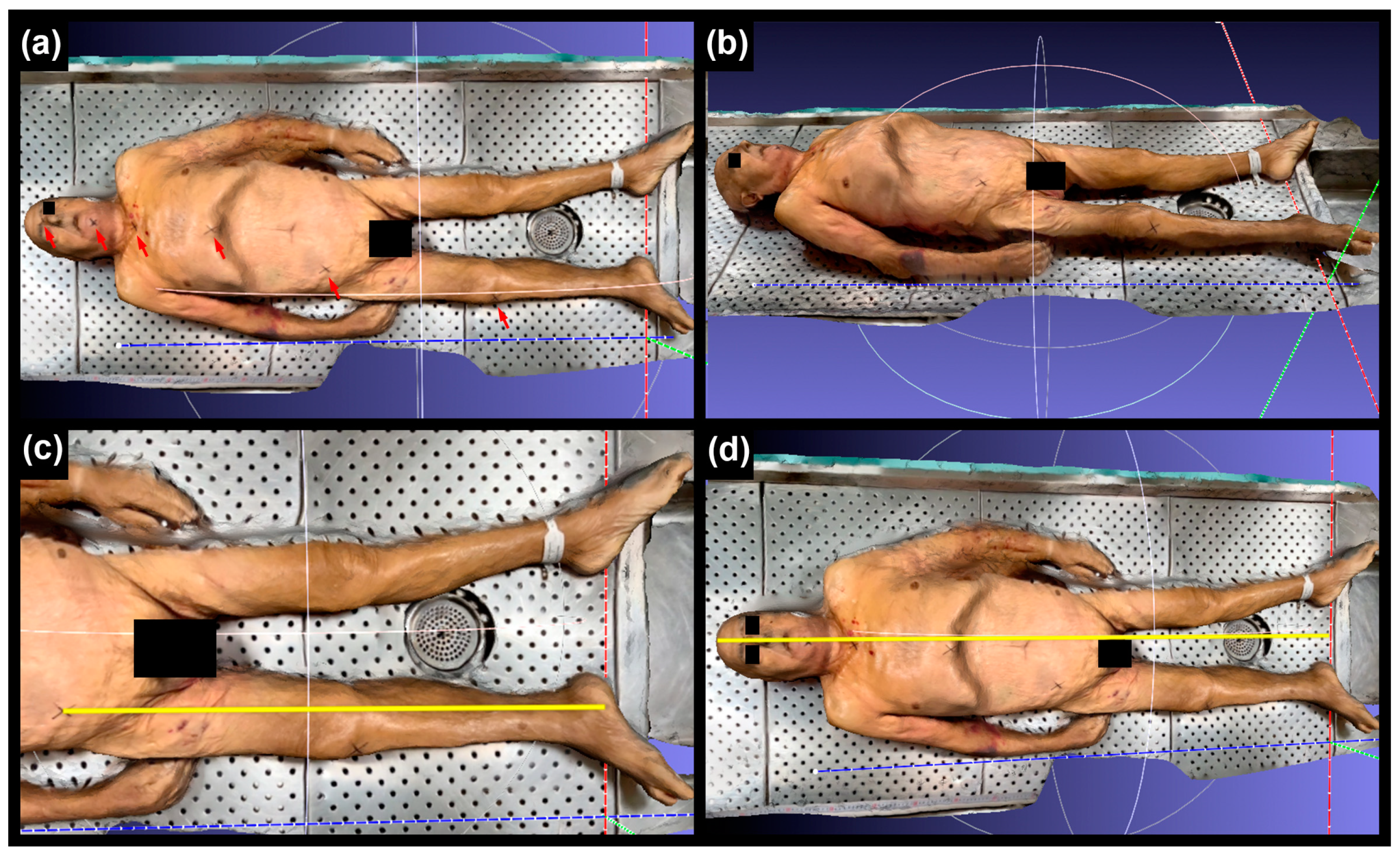 Sensors 24 00500 g002