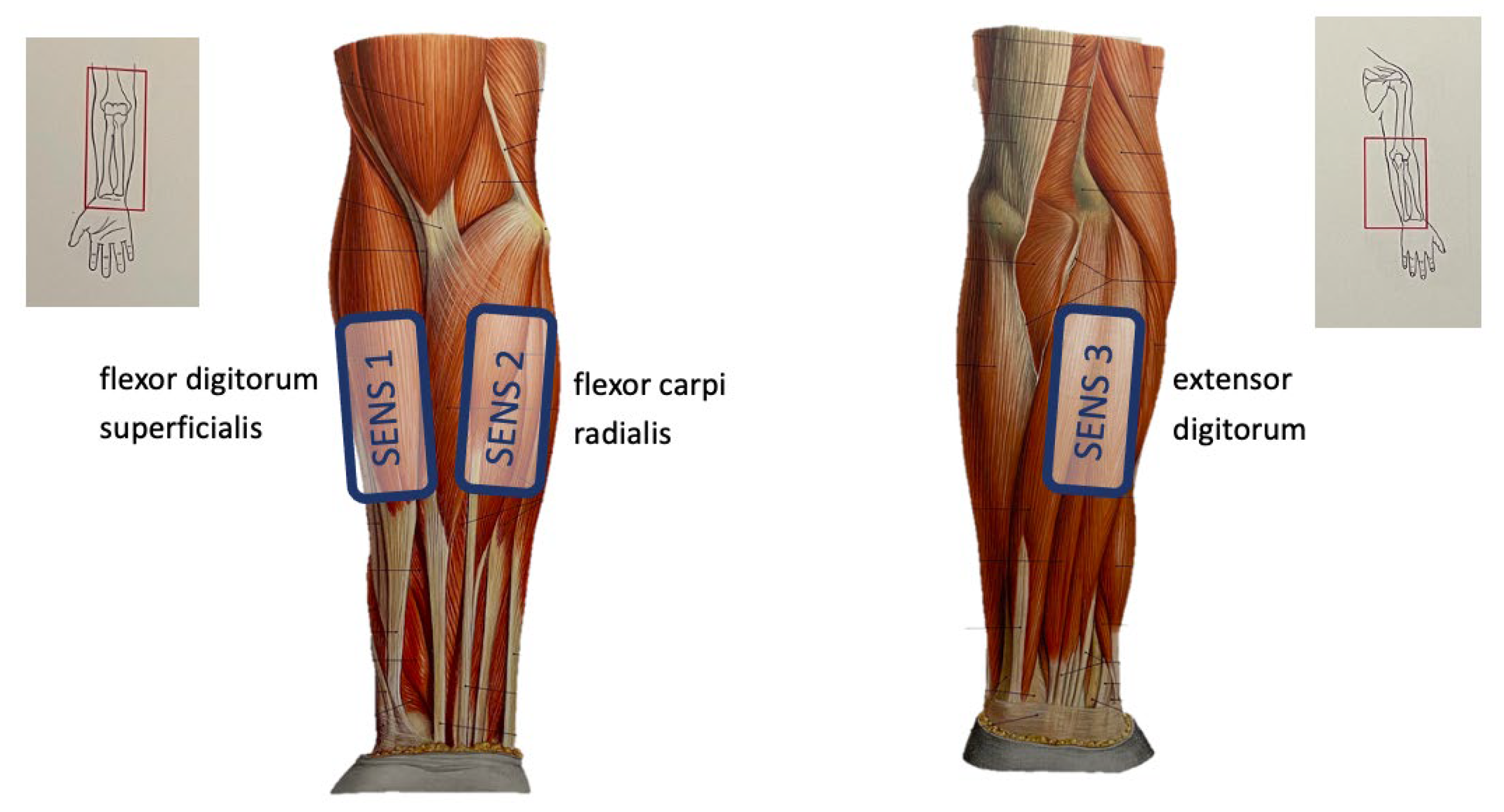 Sensors 24 01119 g006