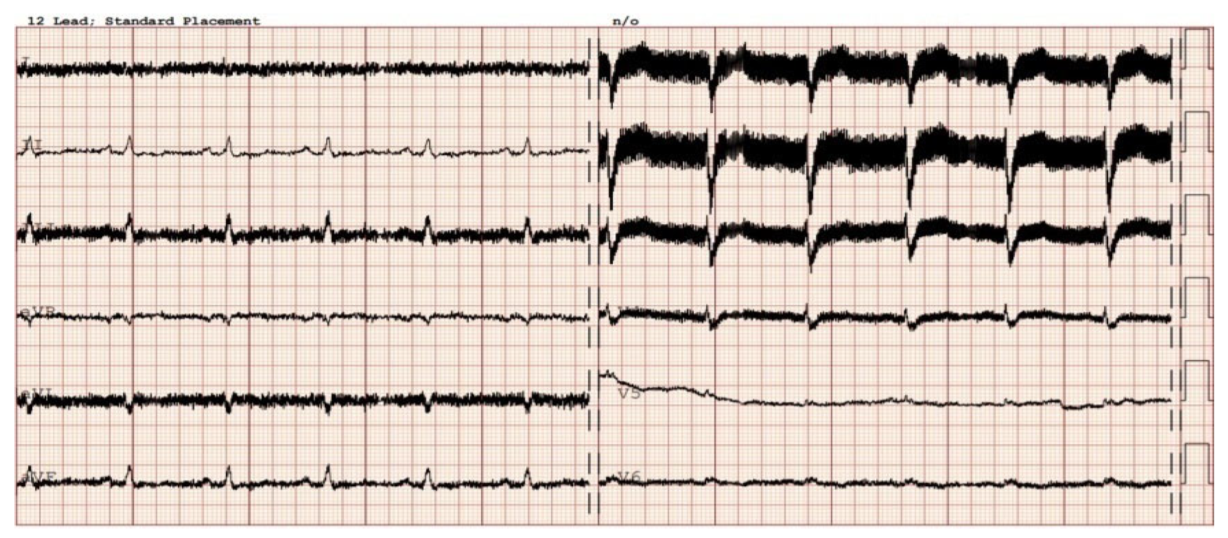 Sensors 24 01124 g004