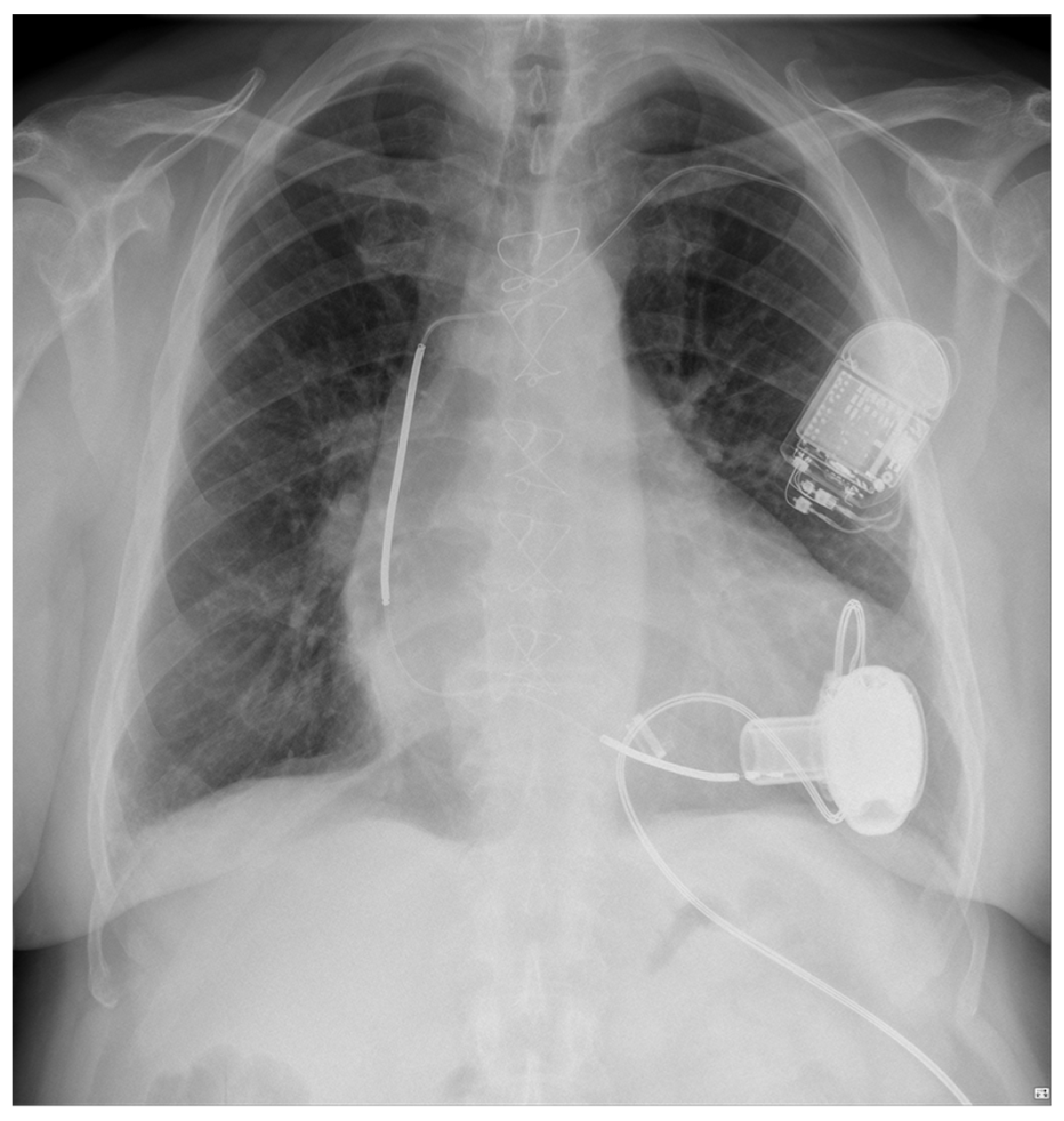 Sensors 24 01124 g006