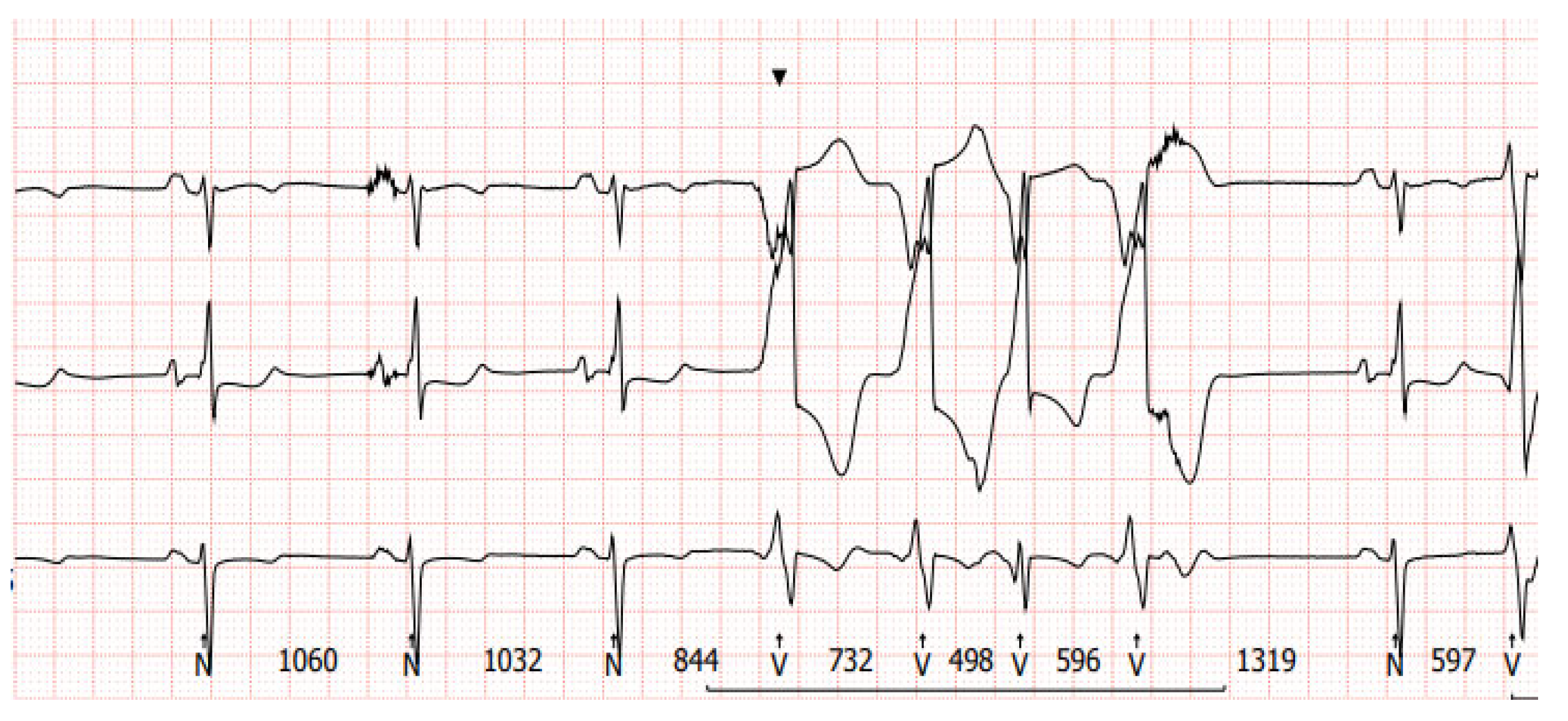 Sensors 24 01124 g007