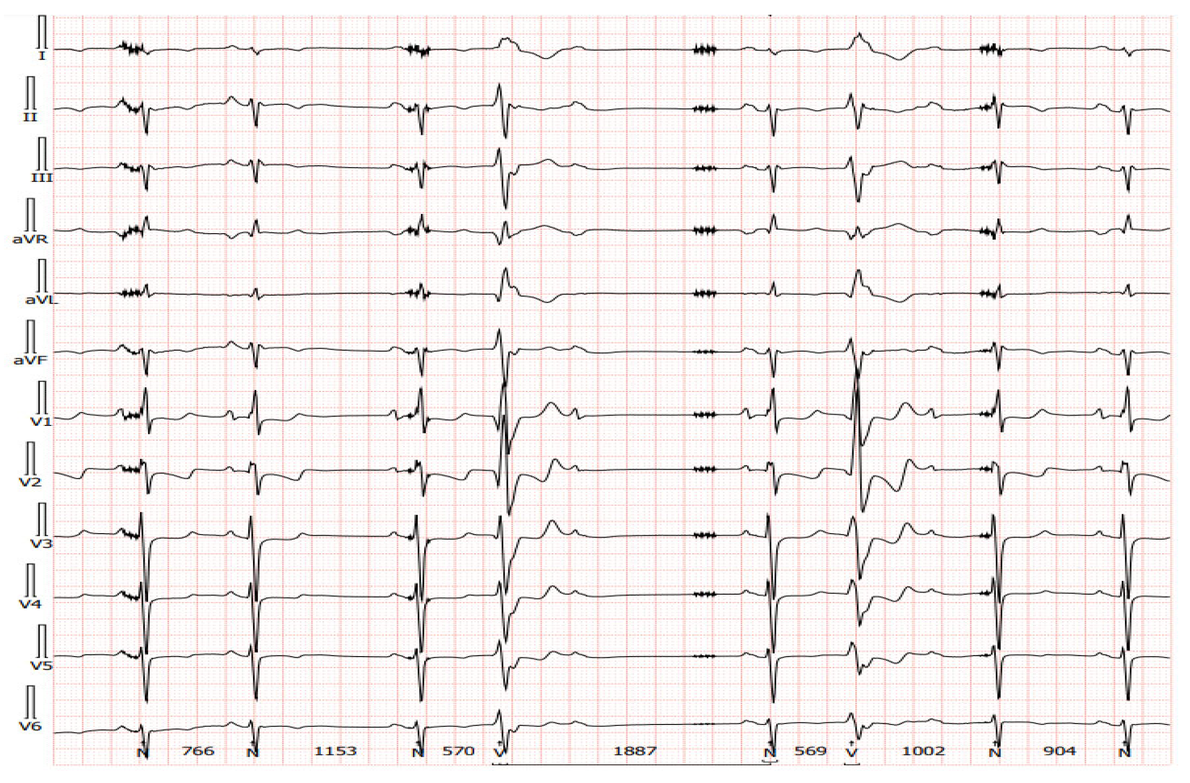 Sensors 24 01124 g008