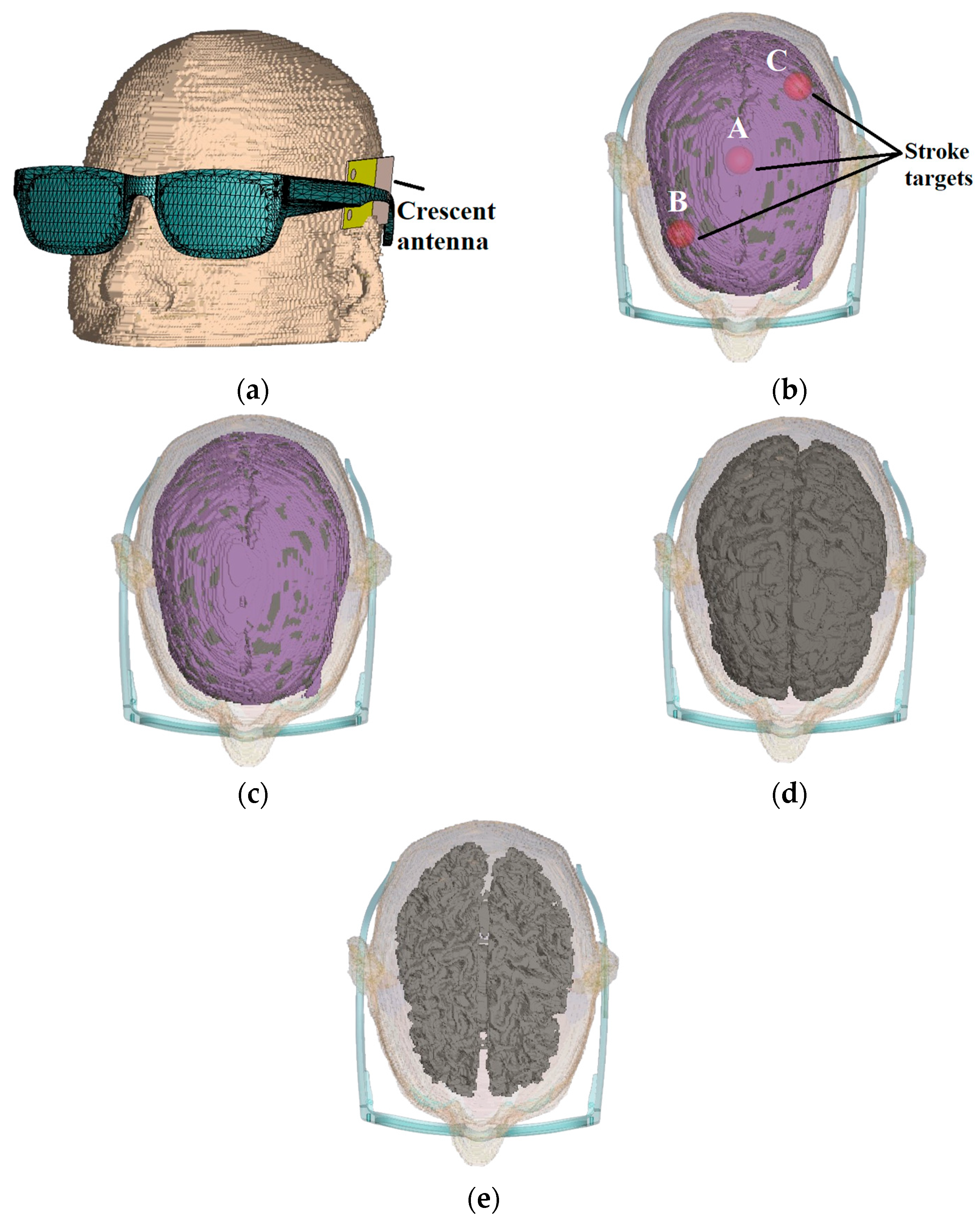 Sensors 24 01305 g013