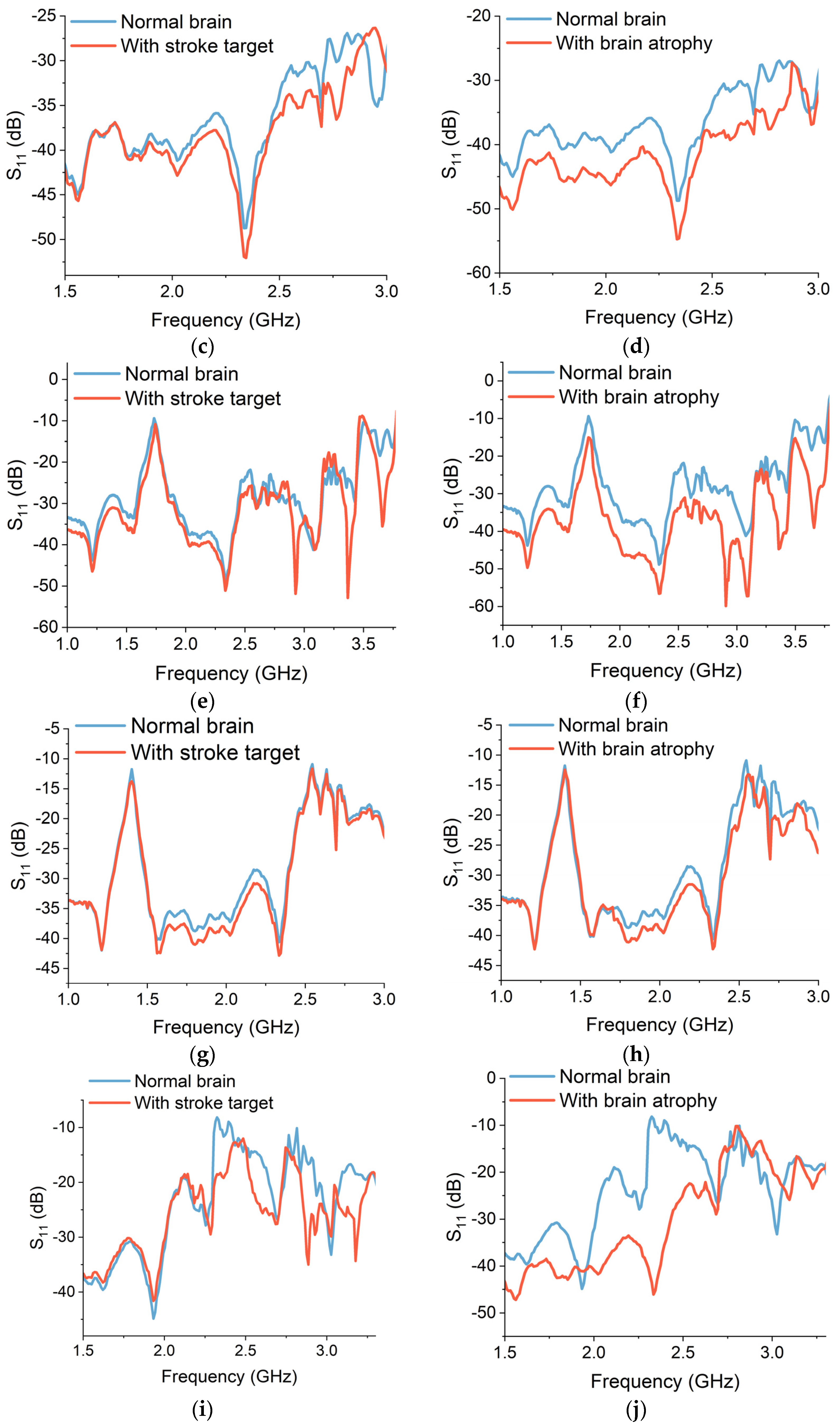Sensors 24 01305 g017b