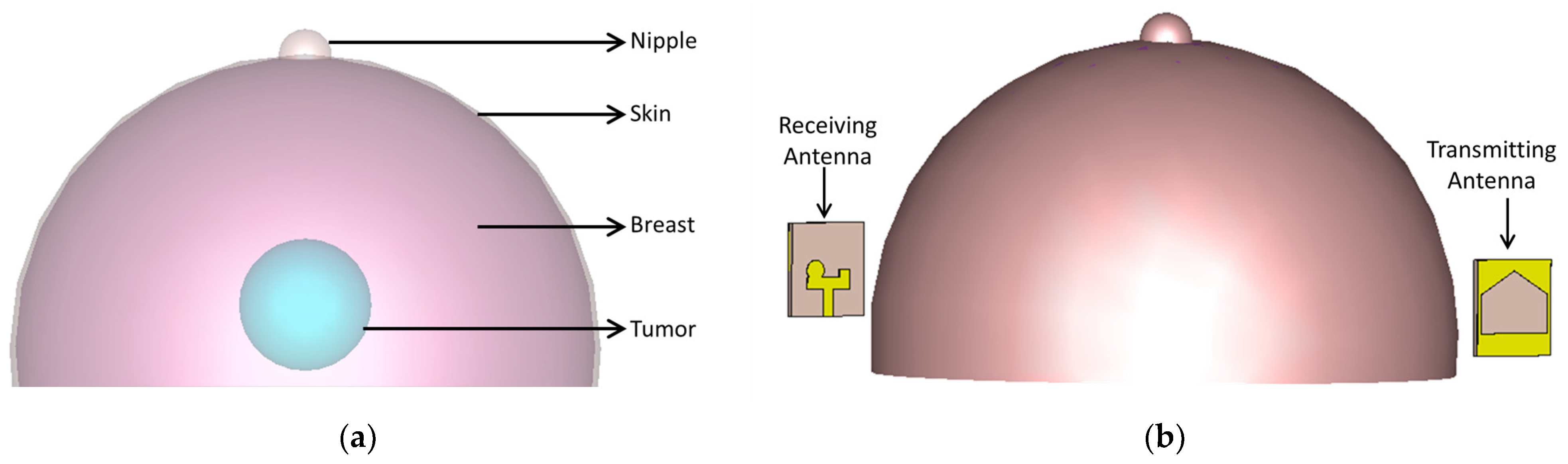 Sensors 24 01315 g013