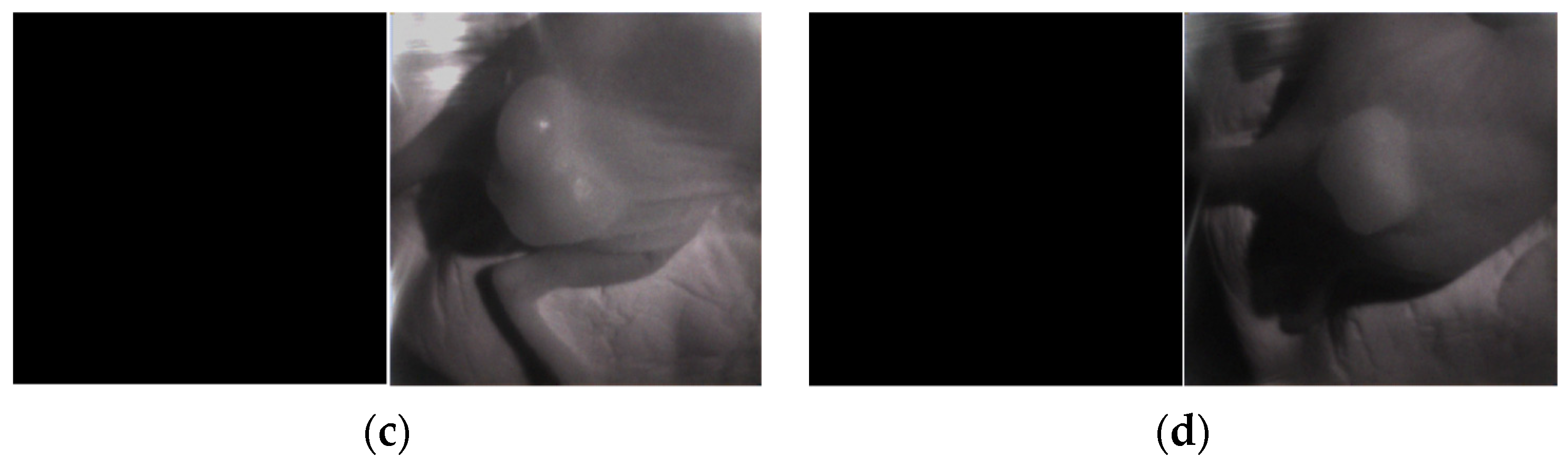 Sensors 24 01487 g005b