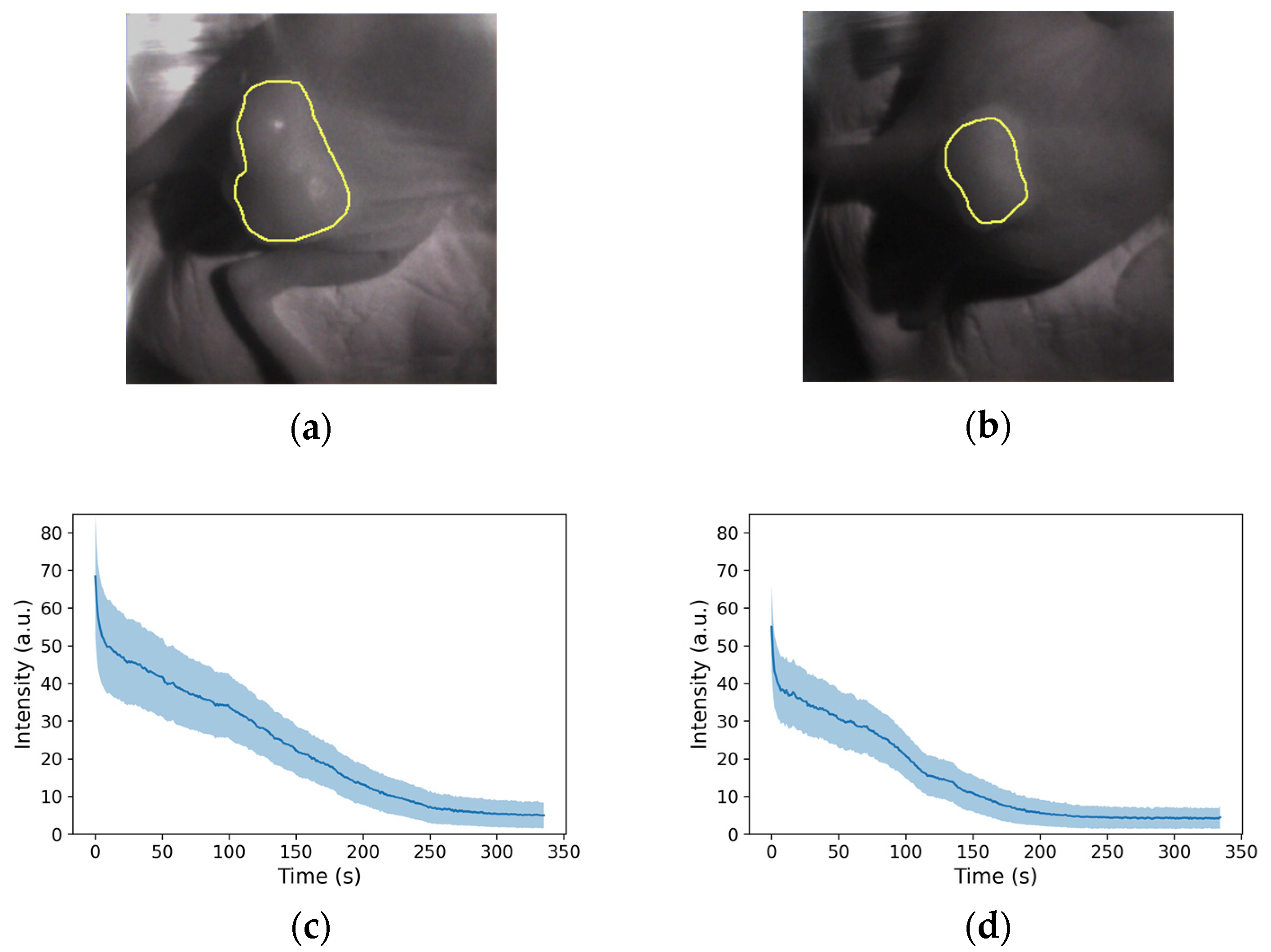 Sensors 24 01487 g006