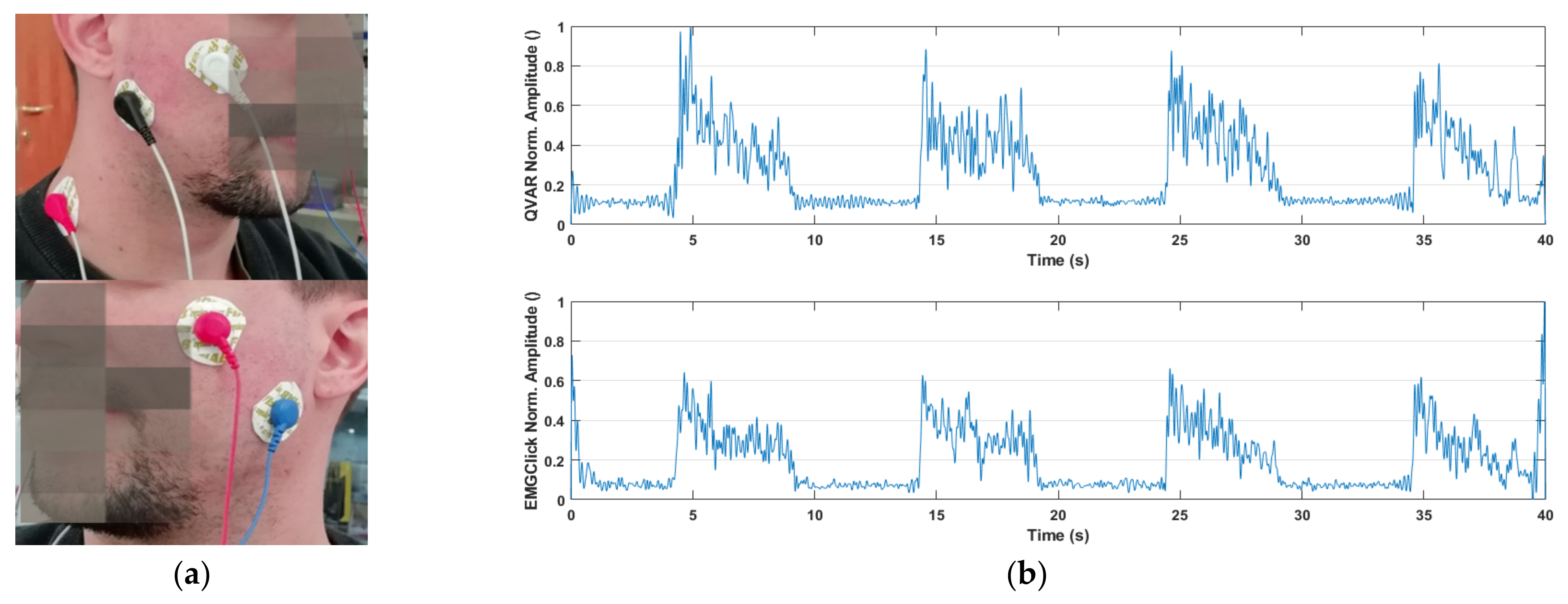 Sensors 24 01554 g007 Sensors 24 01554 g007