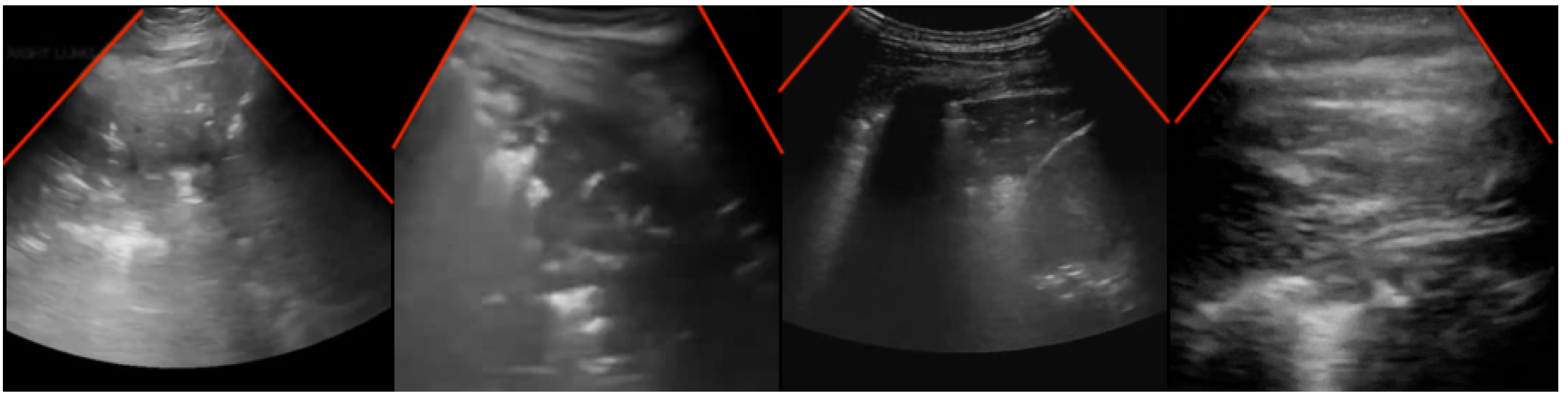 Sensors 24 01664 g001