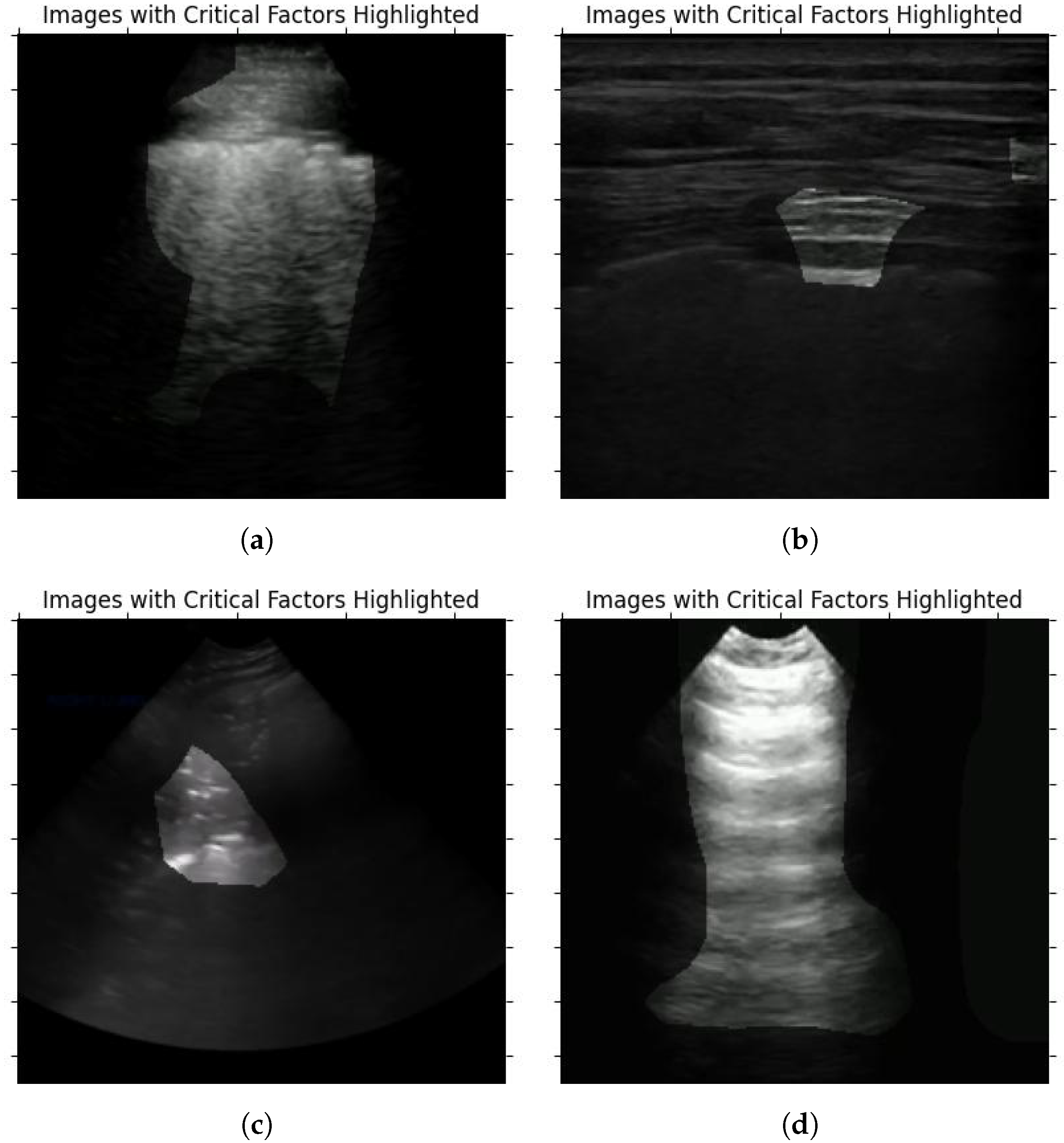 Sensors 24 01664 g007
