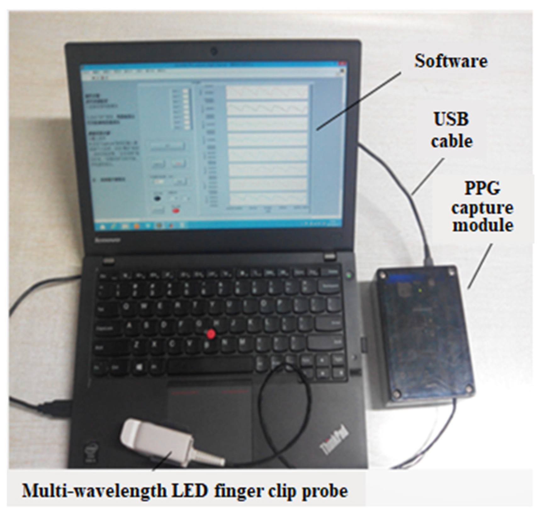 Sensors 24 01736 g002