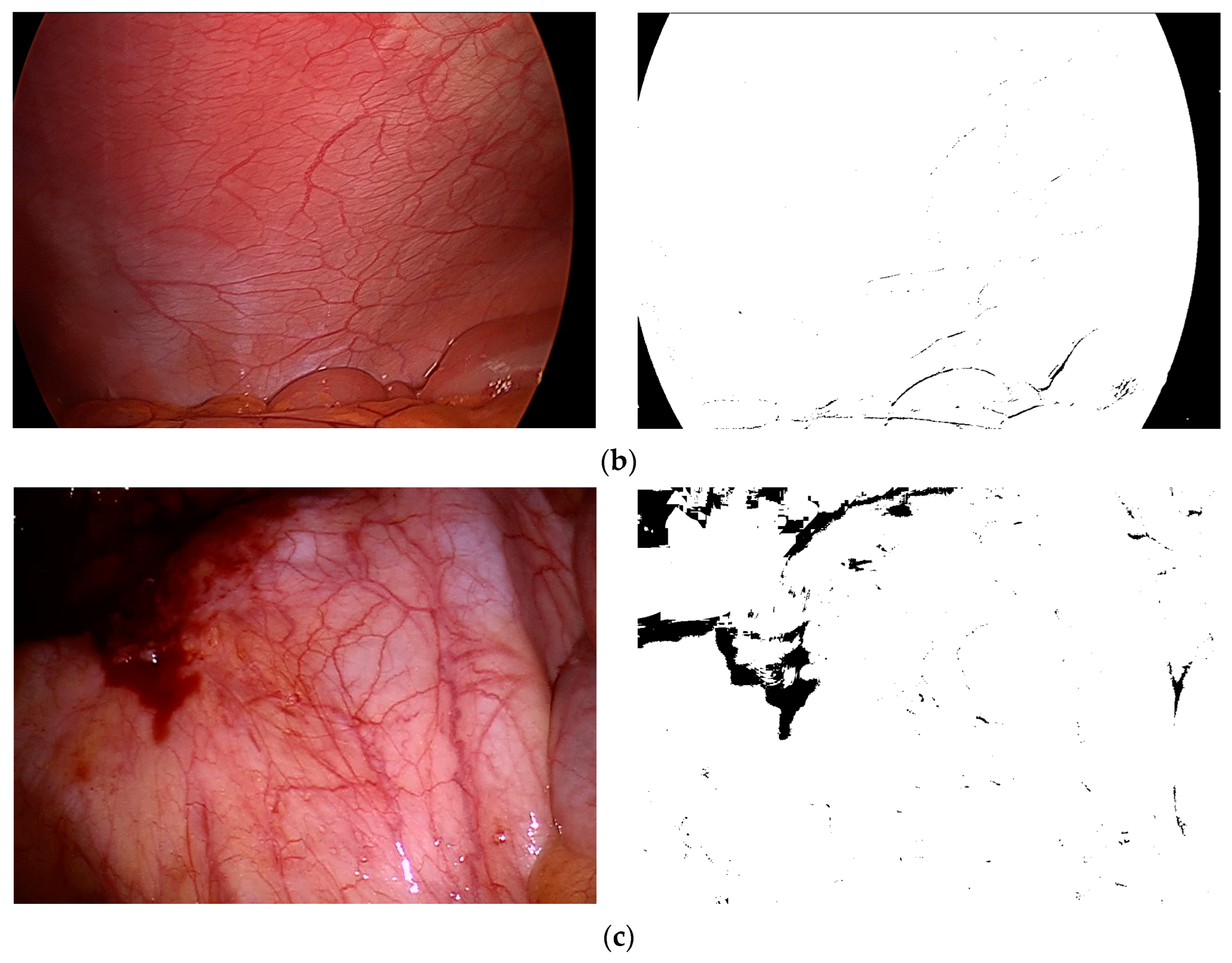 Sensors 24 01880 g003b