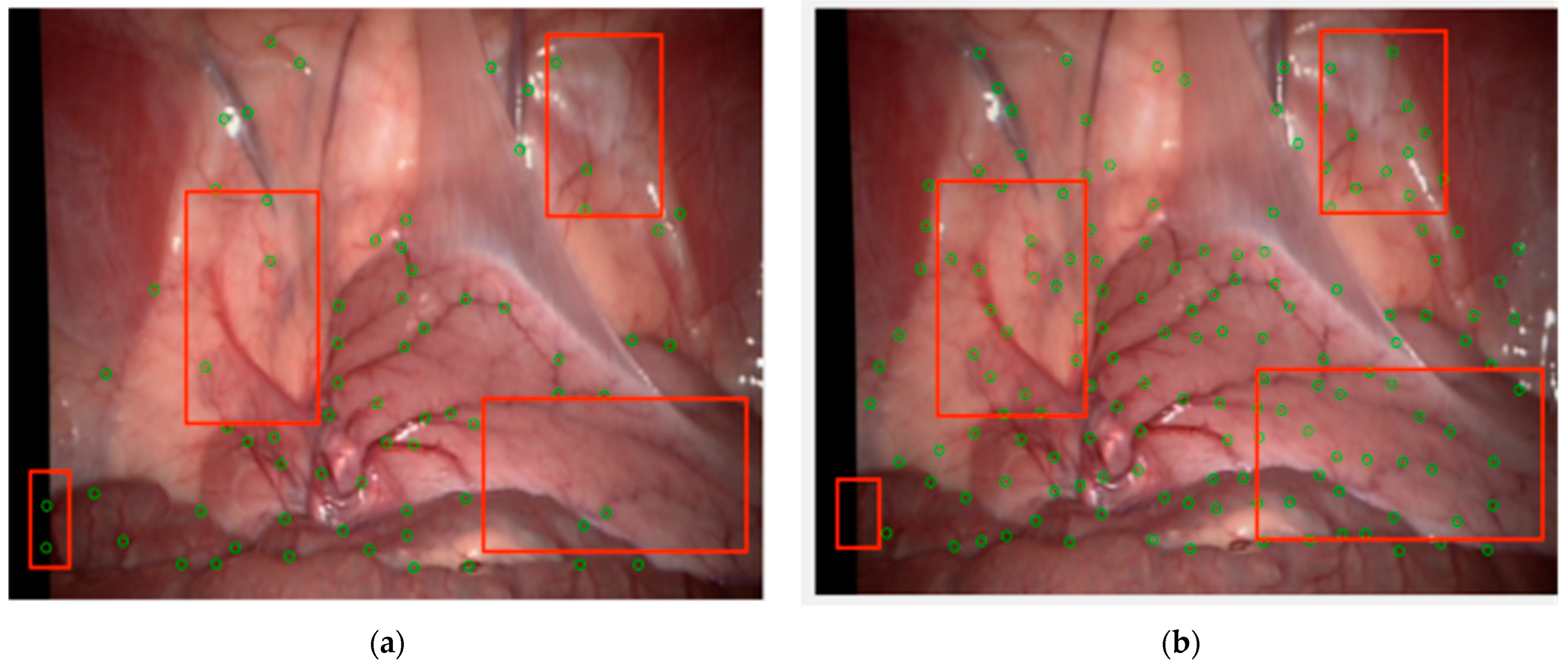 Sensors 24 01880 g010