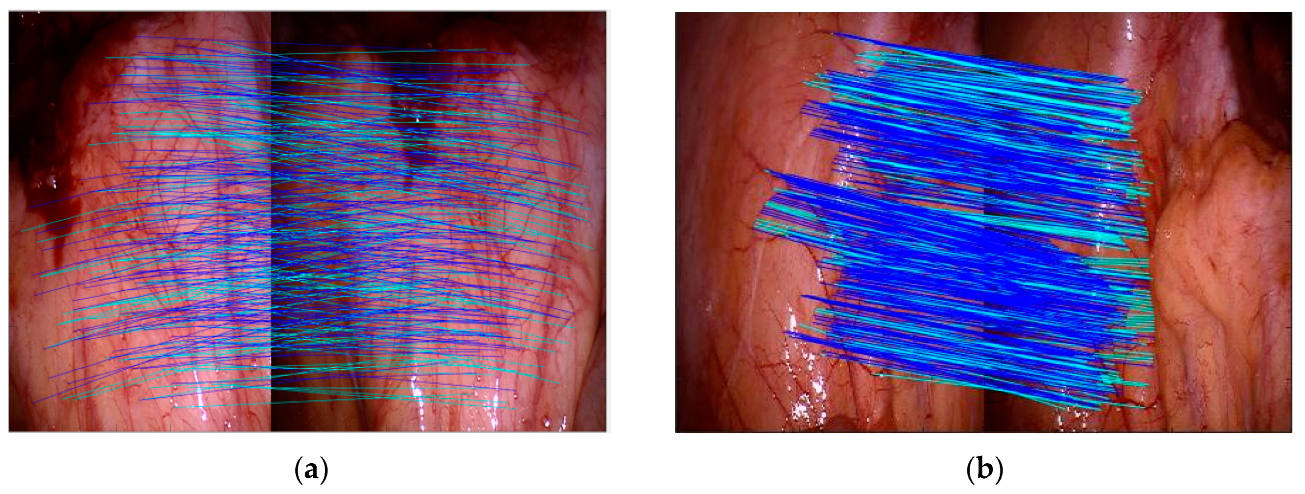 Sensors 24 01880 g011