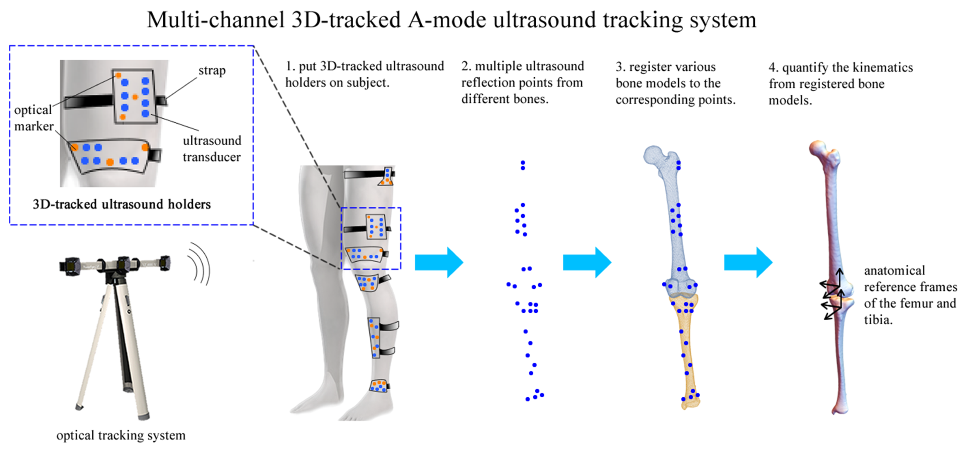 A Method to Track 3D Knee Kinematics by Multi-Channel 3D-Tracked A 