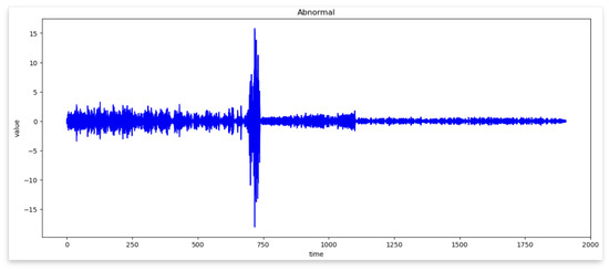 Sensors | Free Full-Text | LSTM-Autoencoder Based Anomaly Detection ...