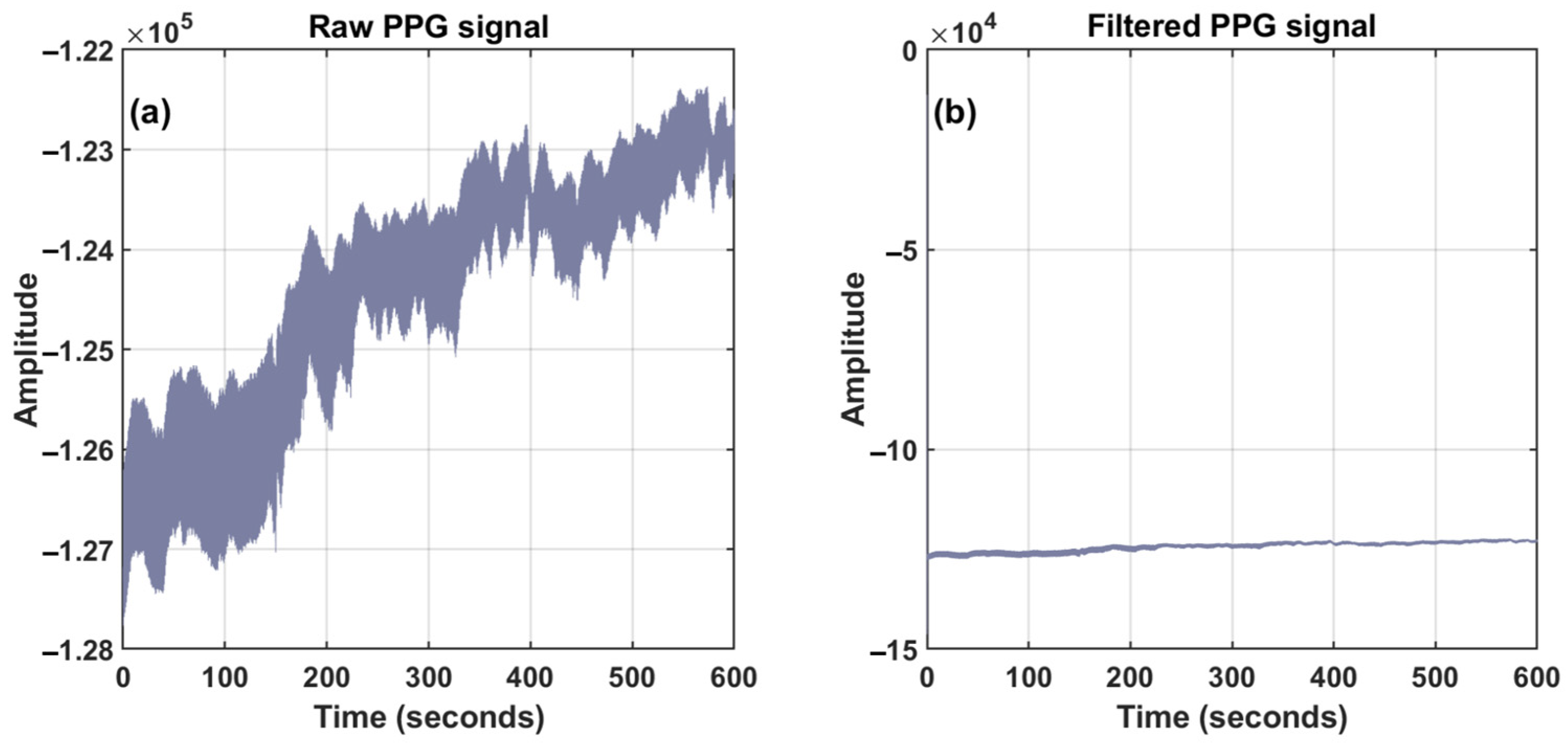 Sensors 24 02925 g005