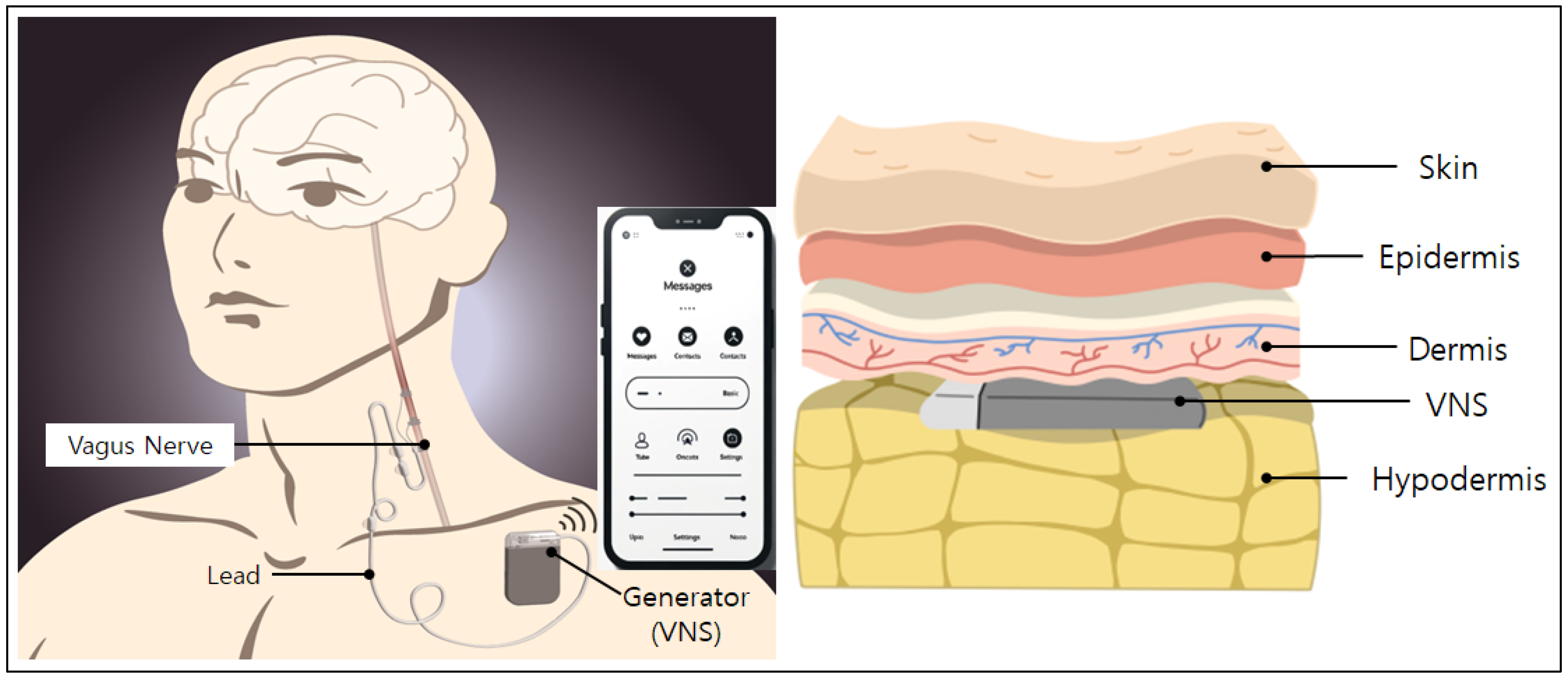 Sensors 24 03172 g001