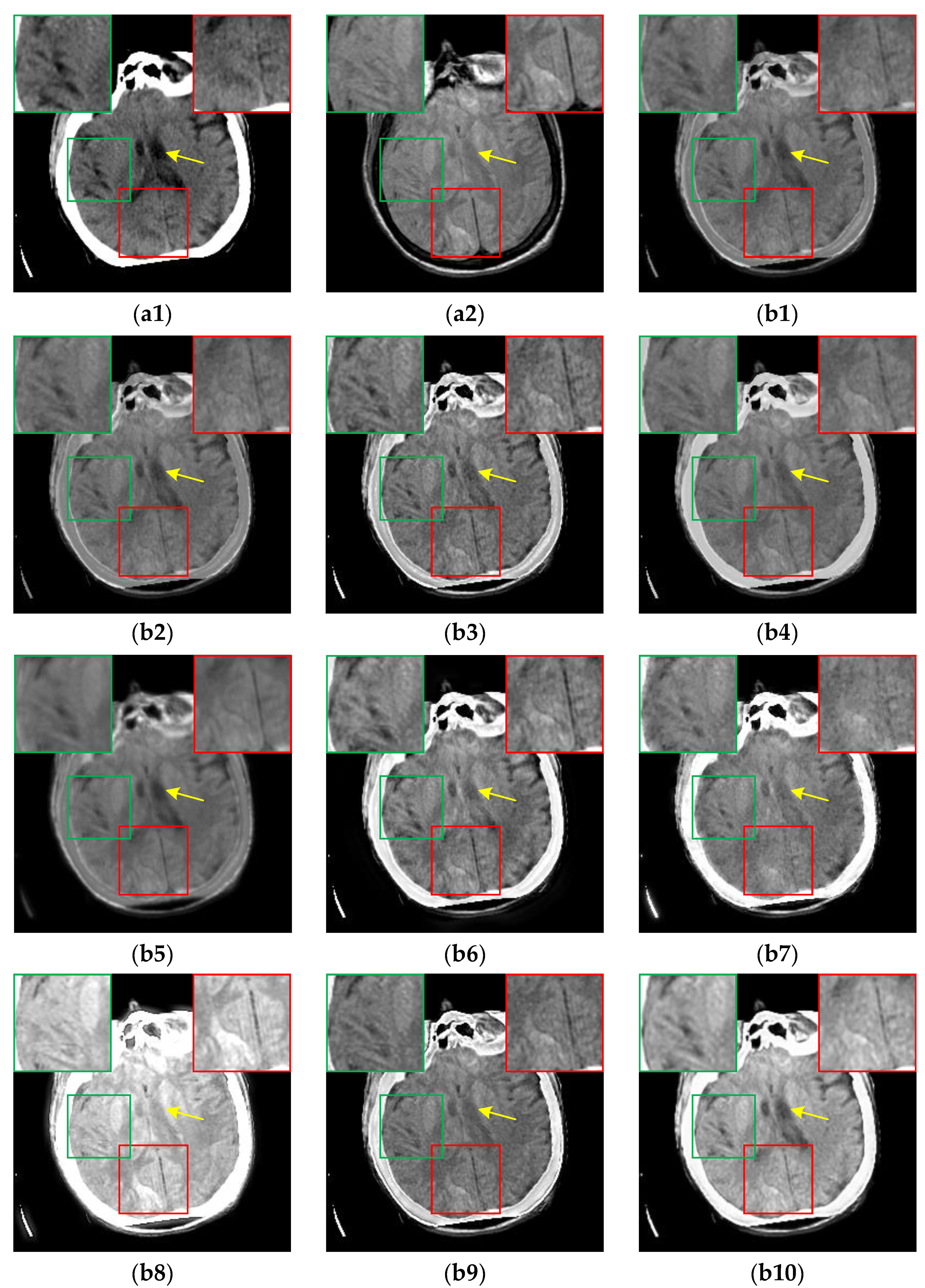 Sensors 24 03545 g006