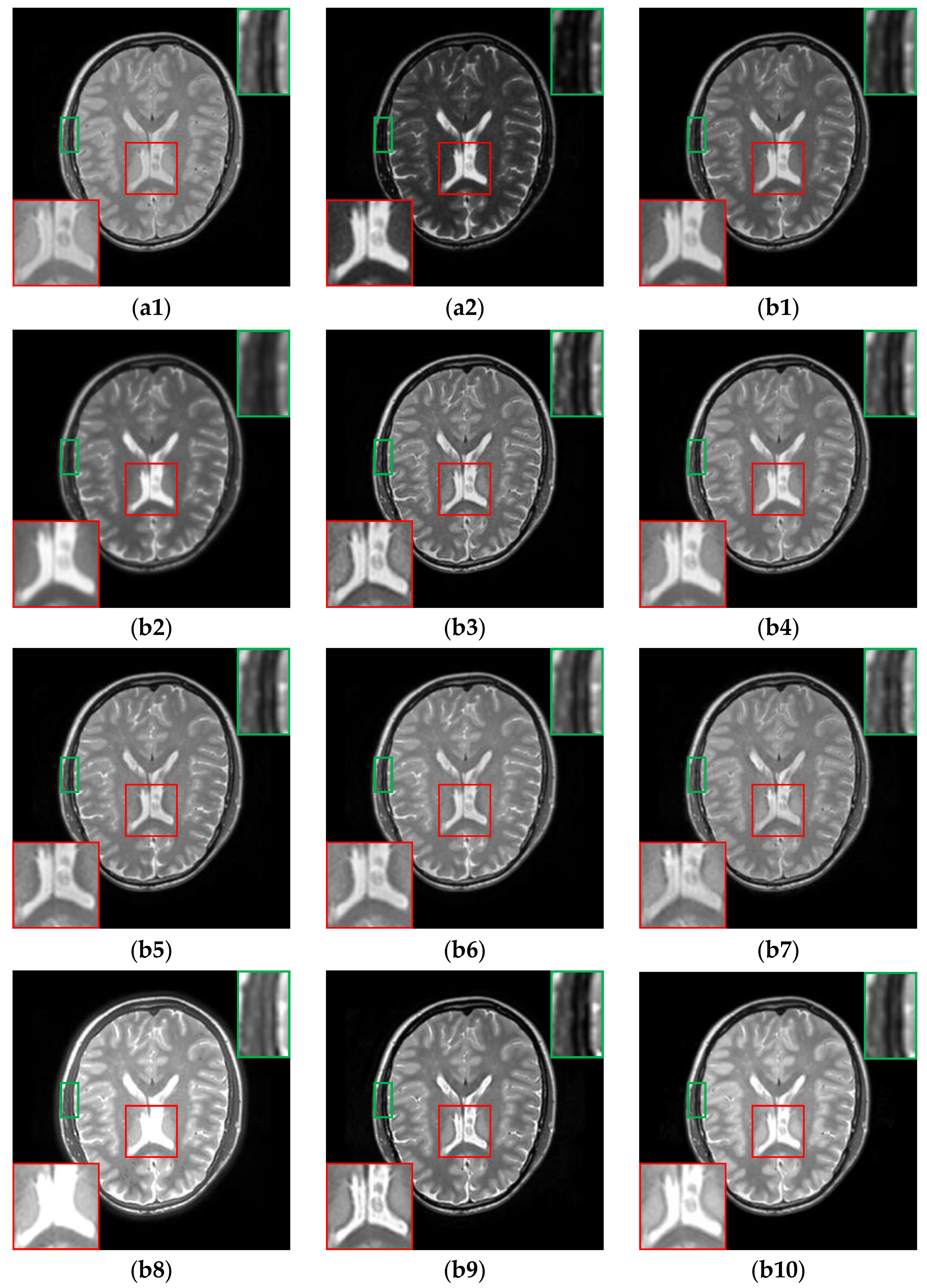Sensors 24 03545 g008
