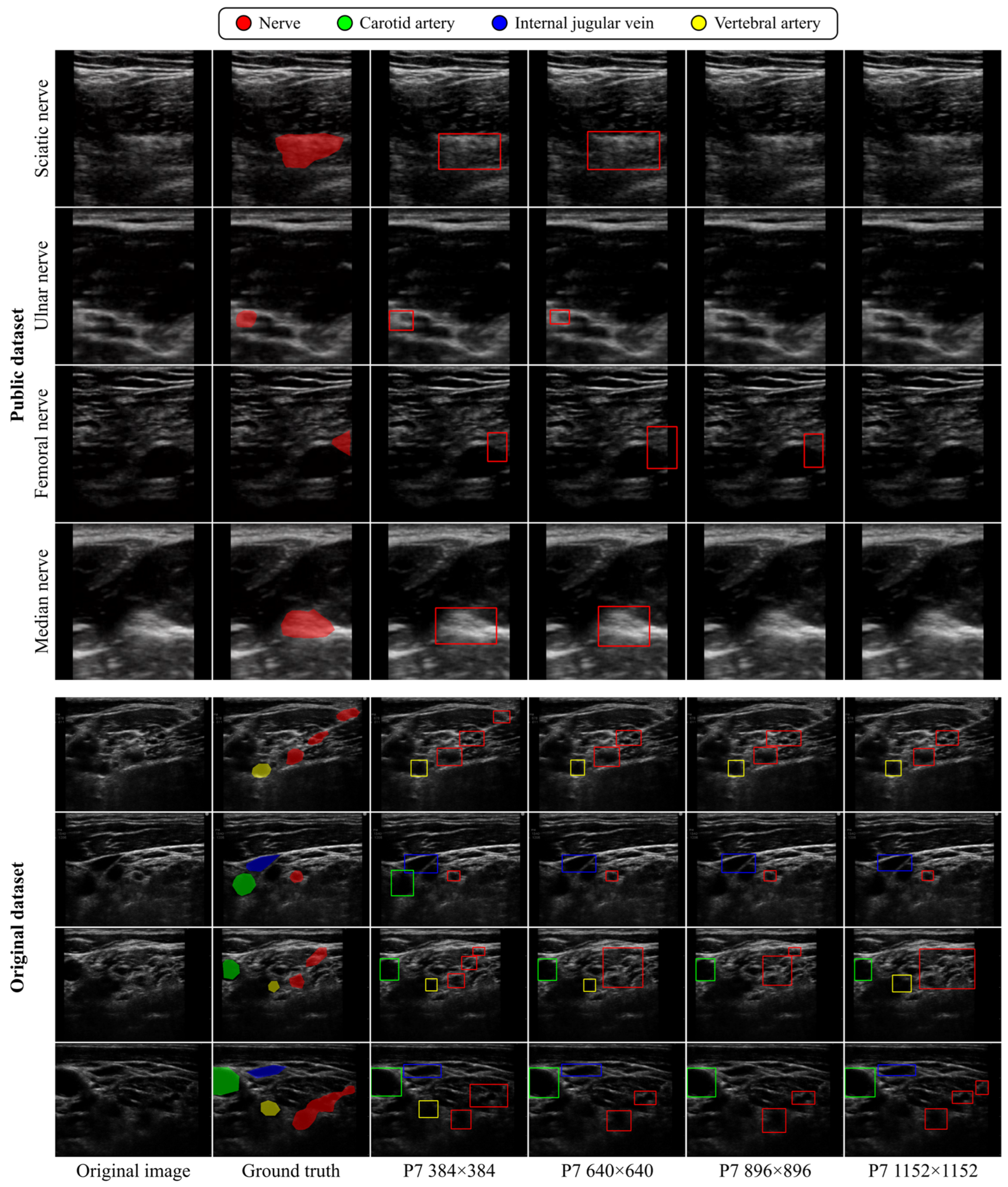 Sensors 24 03696 g007