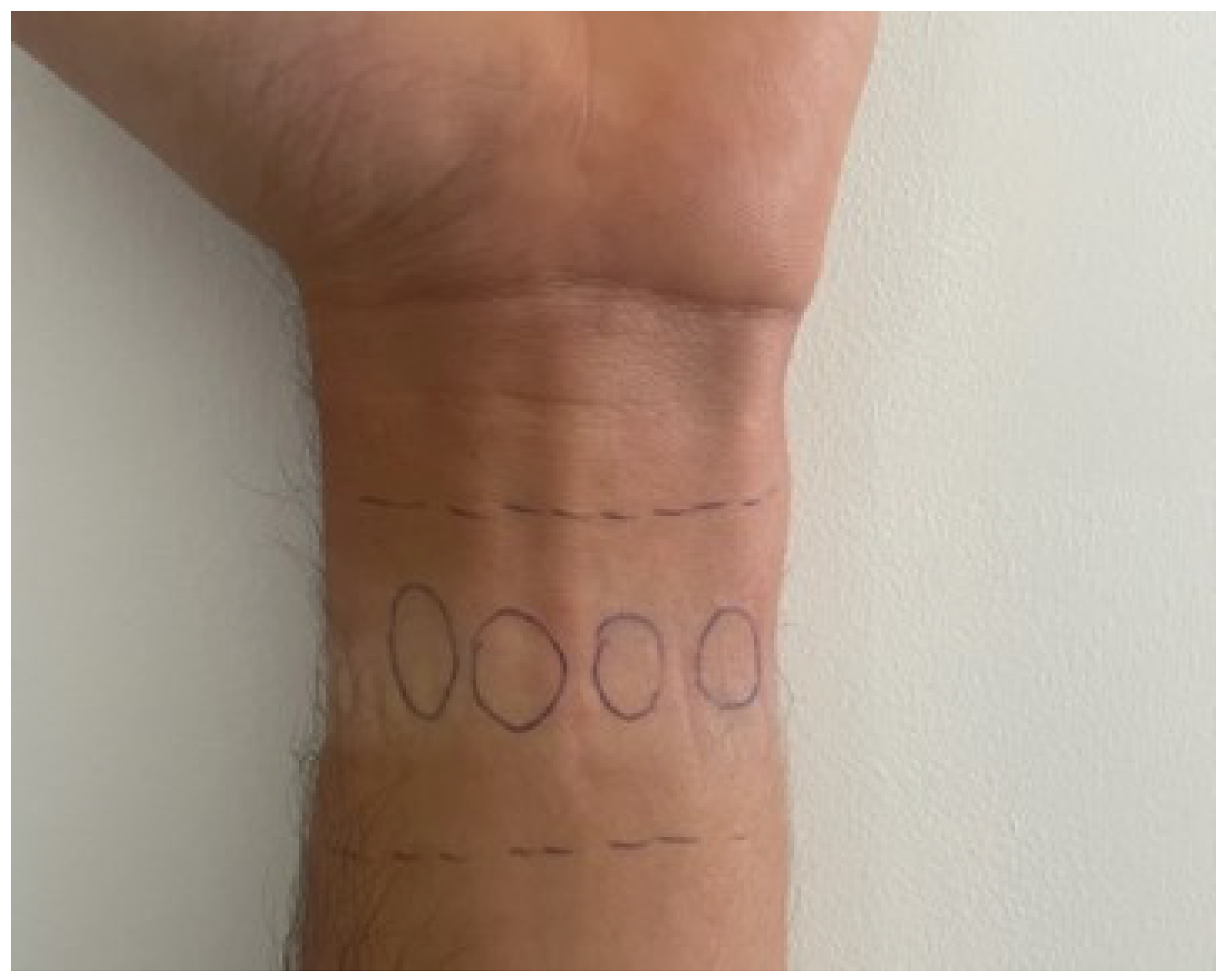 Sensors 24 03766 g003