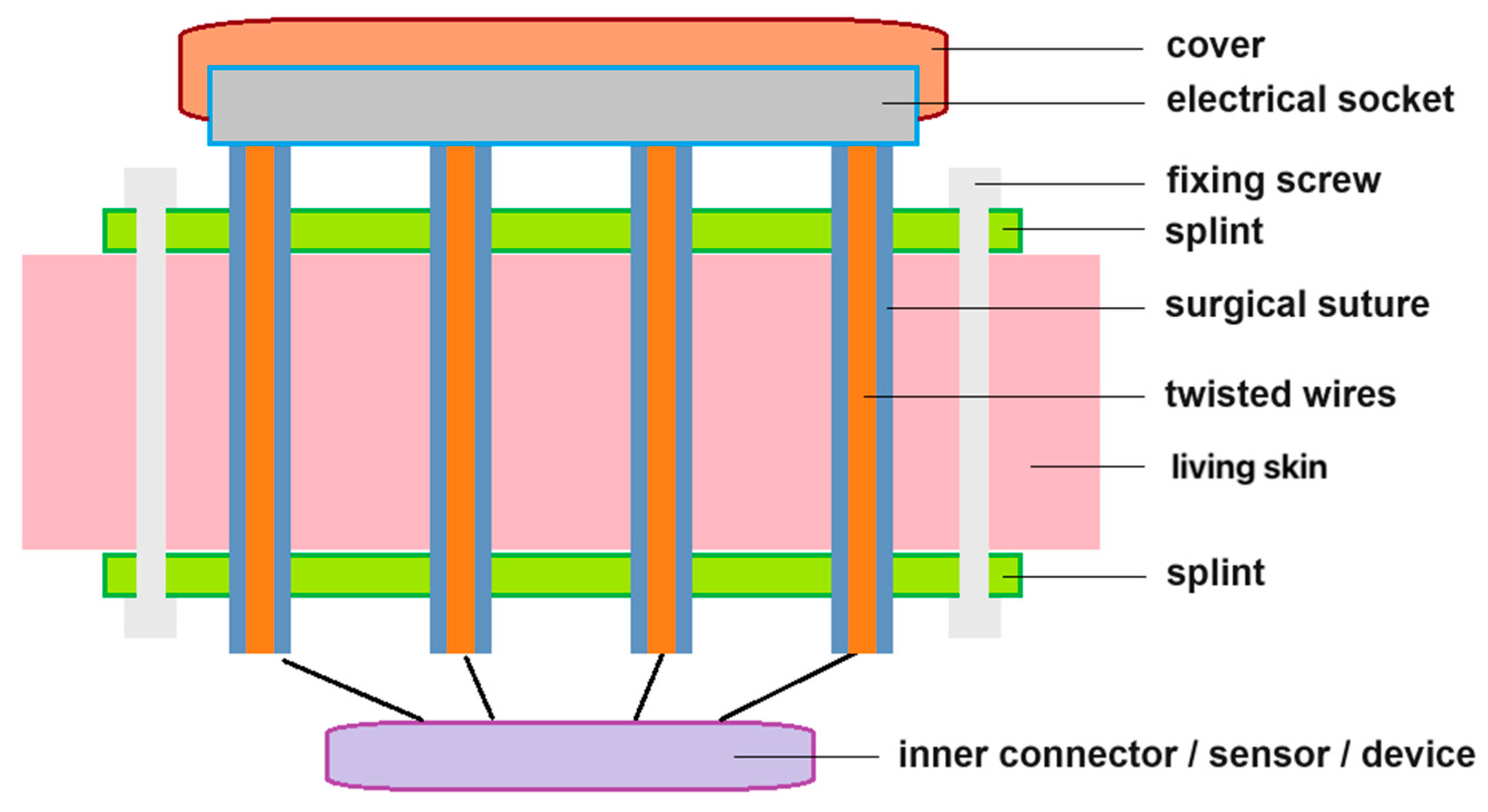 Sensors 24 03799 g005